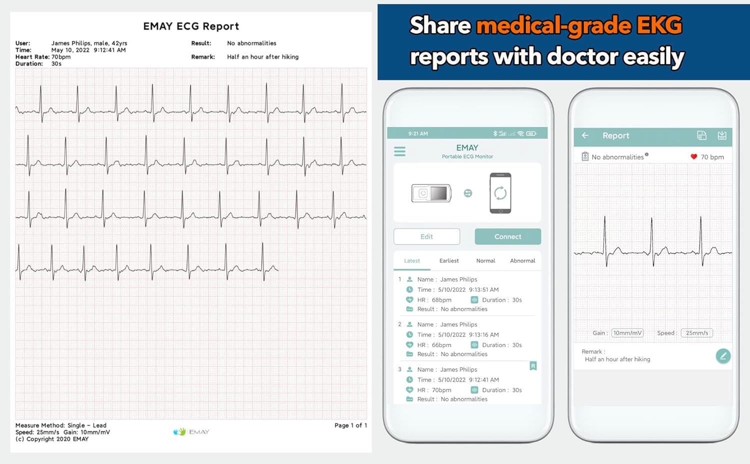 Detalle 2 de EMAY Portable ECG/EKG Monitor 1‑lead