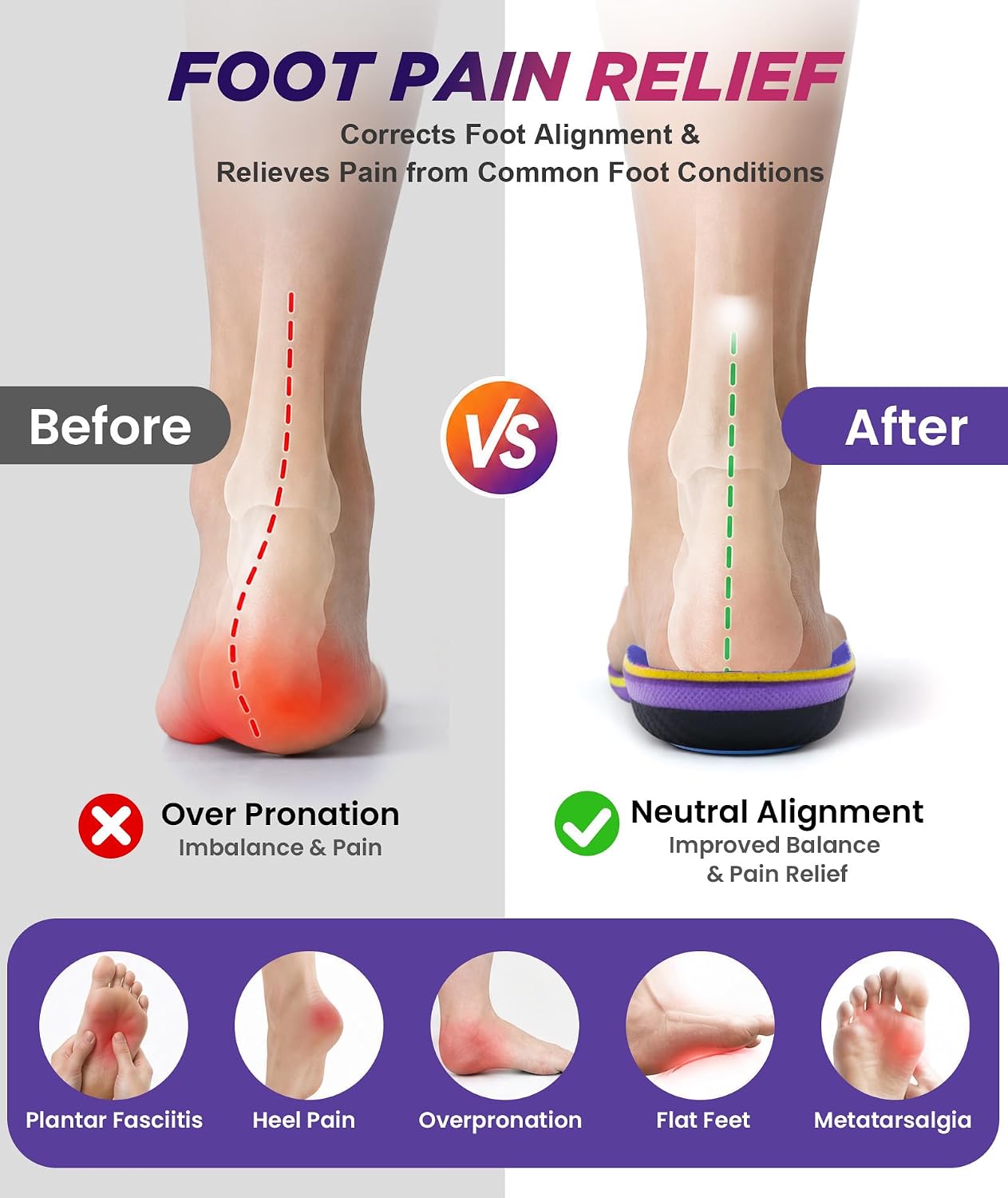 Thumbnail 3 de Plantar Fasciitis Support Insoles for Men & Women – High Arch, Poron Pads & Heel Support