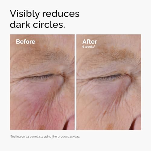 Thumbnail 4 de The Ordinary Caffeine Solution 5% + EGCG Eye Serum — Depuffing & Brightening for Tired Eyes