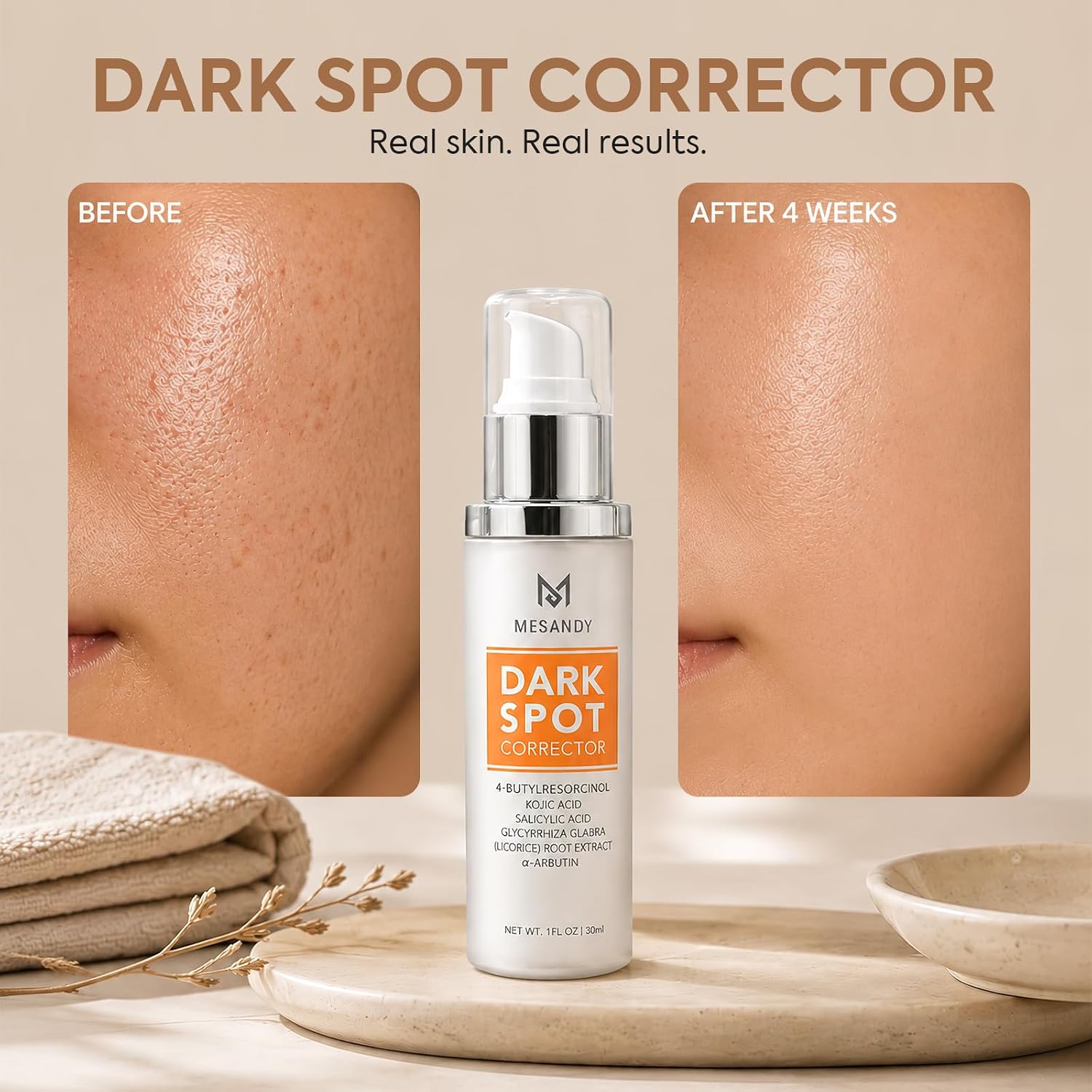 Thumbnail 1 de MESANDY Dark Spot Corrector Cream with 2% Tranexamic Acid and 5% Niacinamide