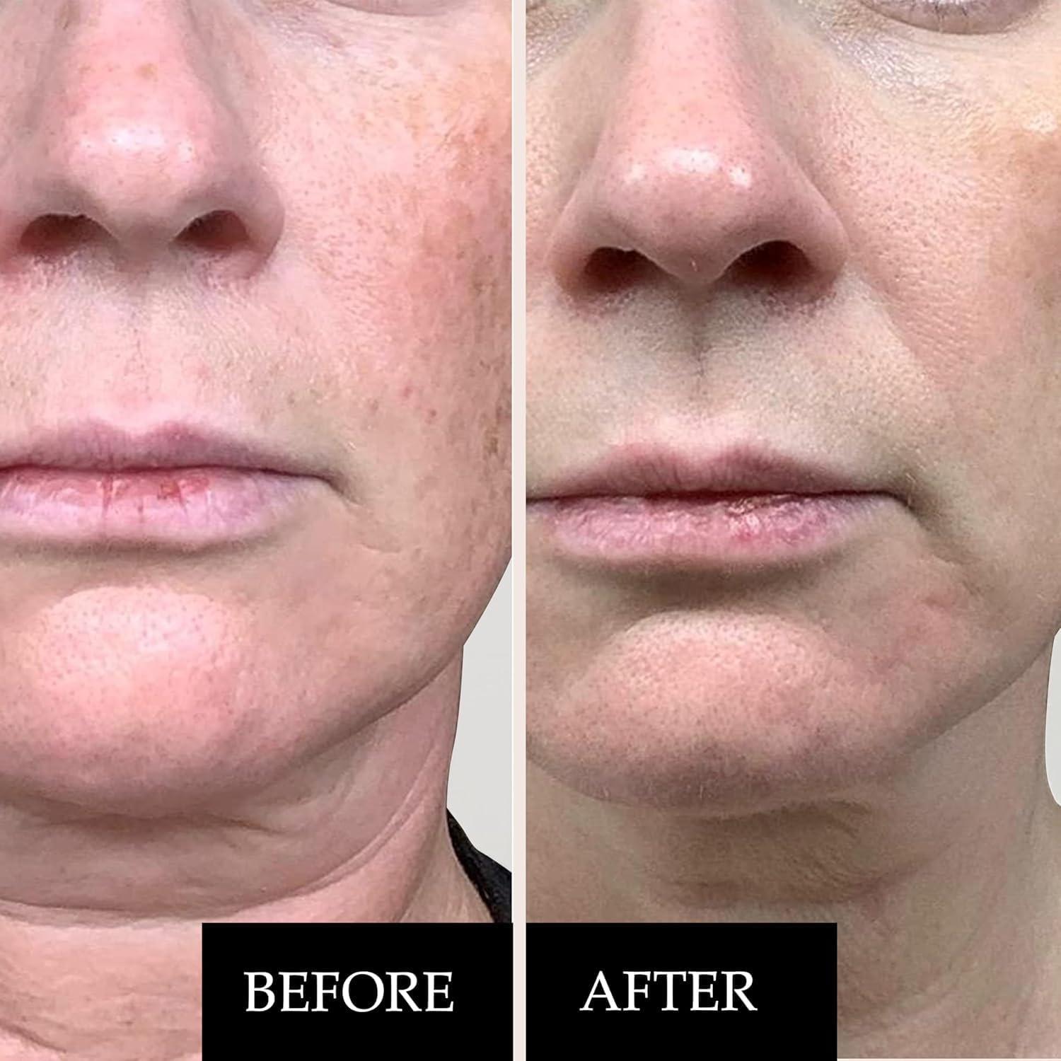 Detalle 2 de Siero Viso Vitamina C 20% anti-macchie