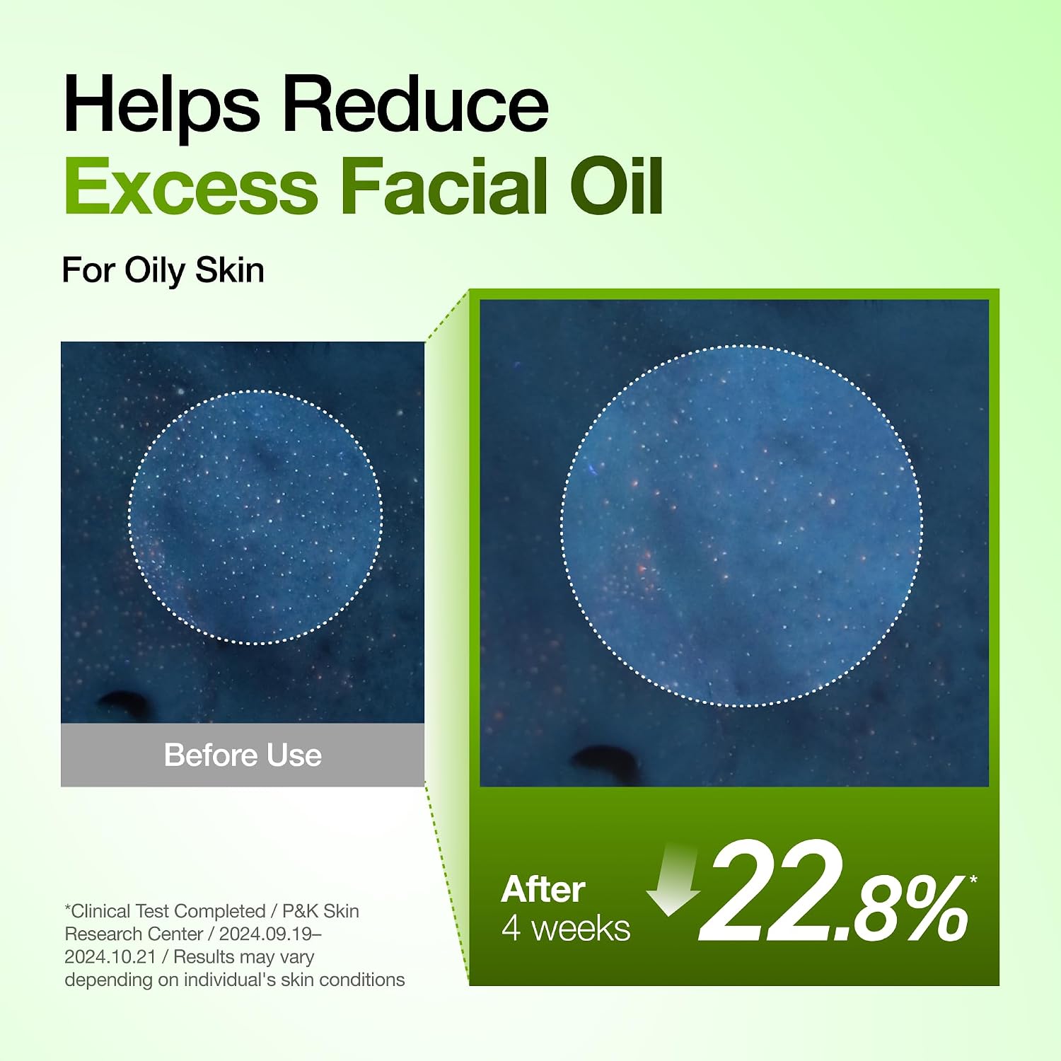 Thumbnail 6 de Anua Azelaic Acid 10 Serum for Redness 30ml