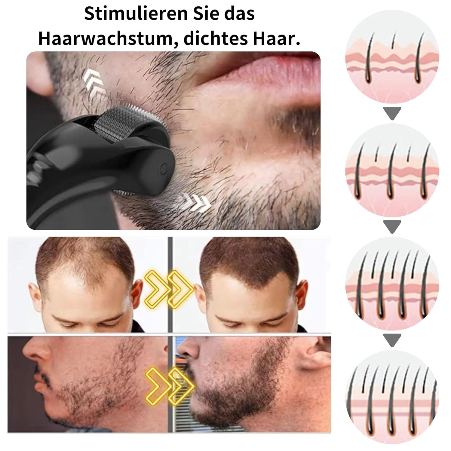 Thumbnail 4 de Derma-Roller 0,5mm Microneedling Roller 540 Nadeln