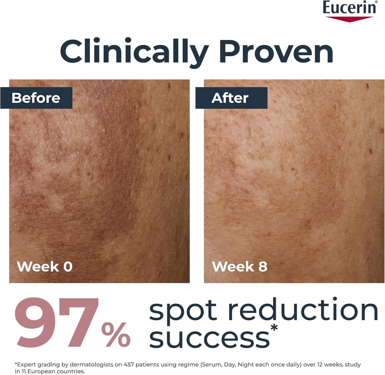 Thumbnail 2 de Eucerin Anti-Pigment Day Cream SPF 30 (50ml) with Thiamidol for Dark Spots