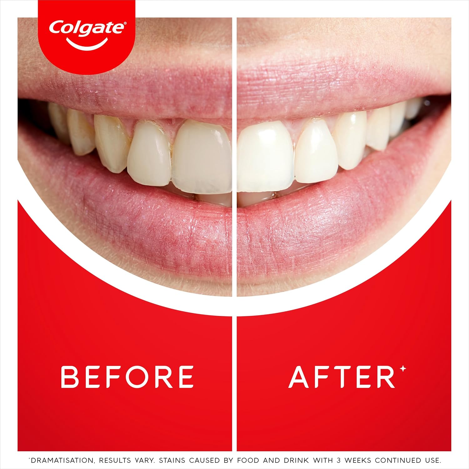 Detalle de Colgate Max White Ultra Active Foam Zahnpasta 2x75 ml – Weißere Zähne in 3 Tagen (Kollektion)