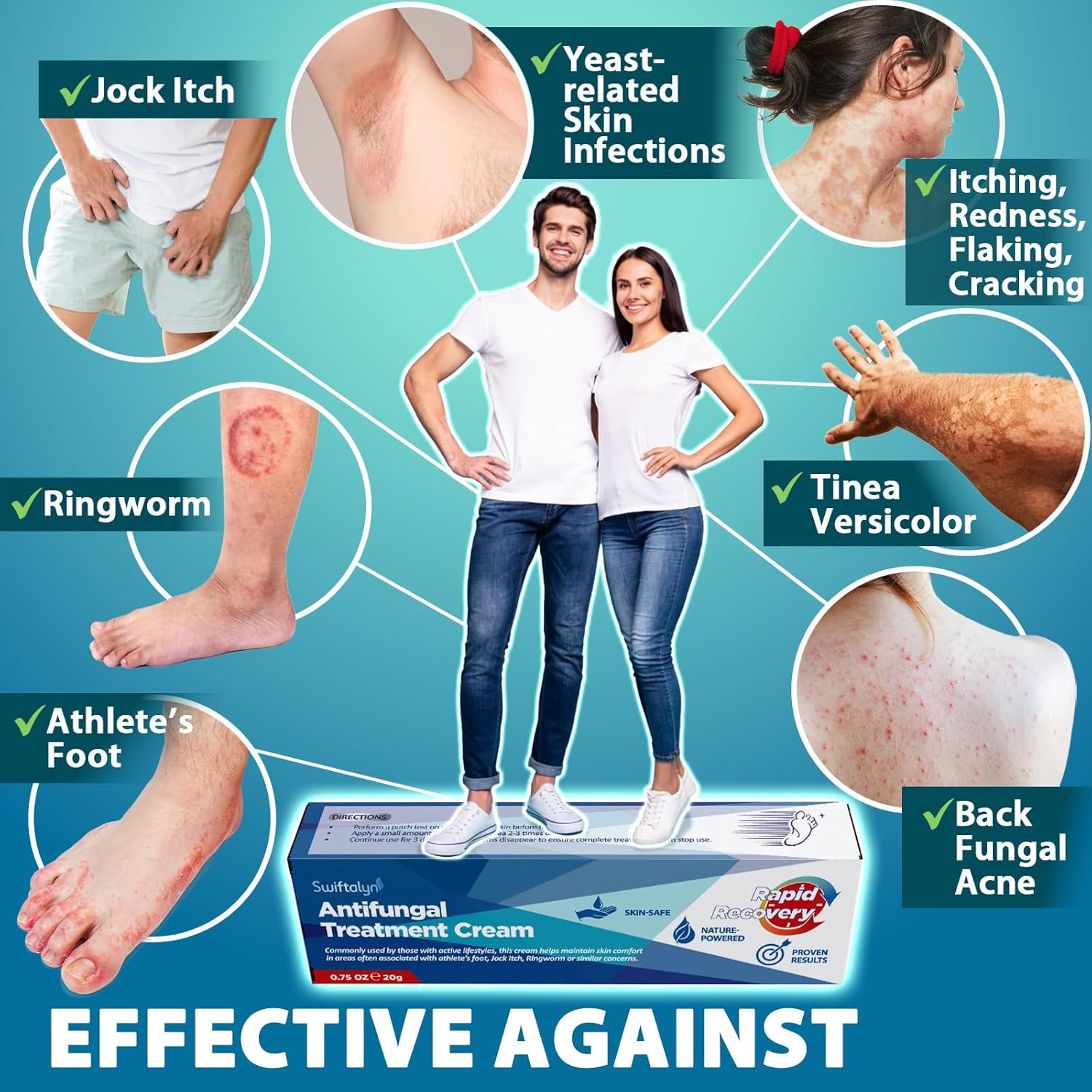 Thumbnail 2 de Antimykotika Salbe und Creme bei Hautpilz & Fußpilz mit Teebaumöl, Aloe Vera und pflanzlichen Extrakten