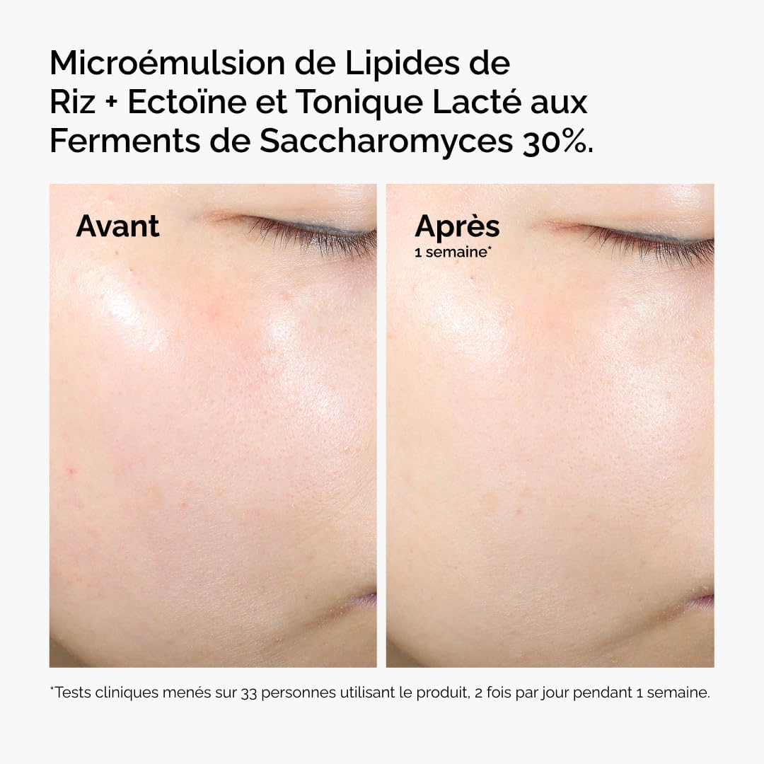 Thumbnail 6 de The Ordinary rijstlipiden + ectoïne micro-emulsiecrème voor droge huid, 120 ml