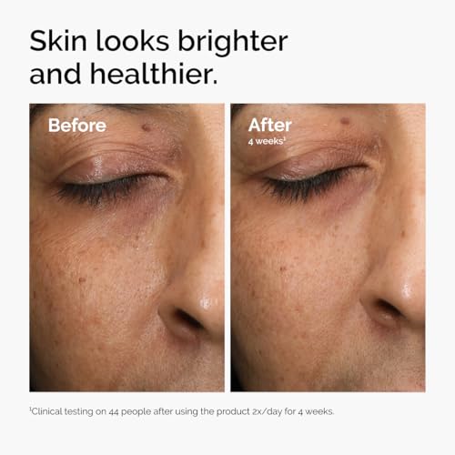 Detalle 2 de The Ordinary Multi-Antioxidant Radiance Serum: Vitamin C Power for Bright, Protected Skin