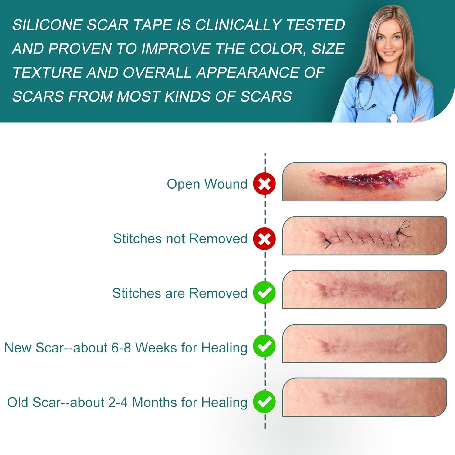 Thumbnail 5 de Silicone Scar Sheets 1.6" x 158" Roll
