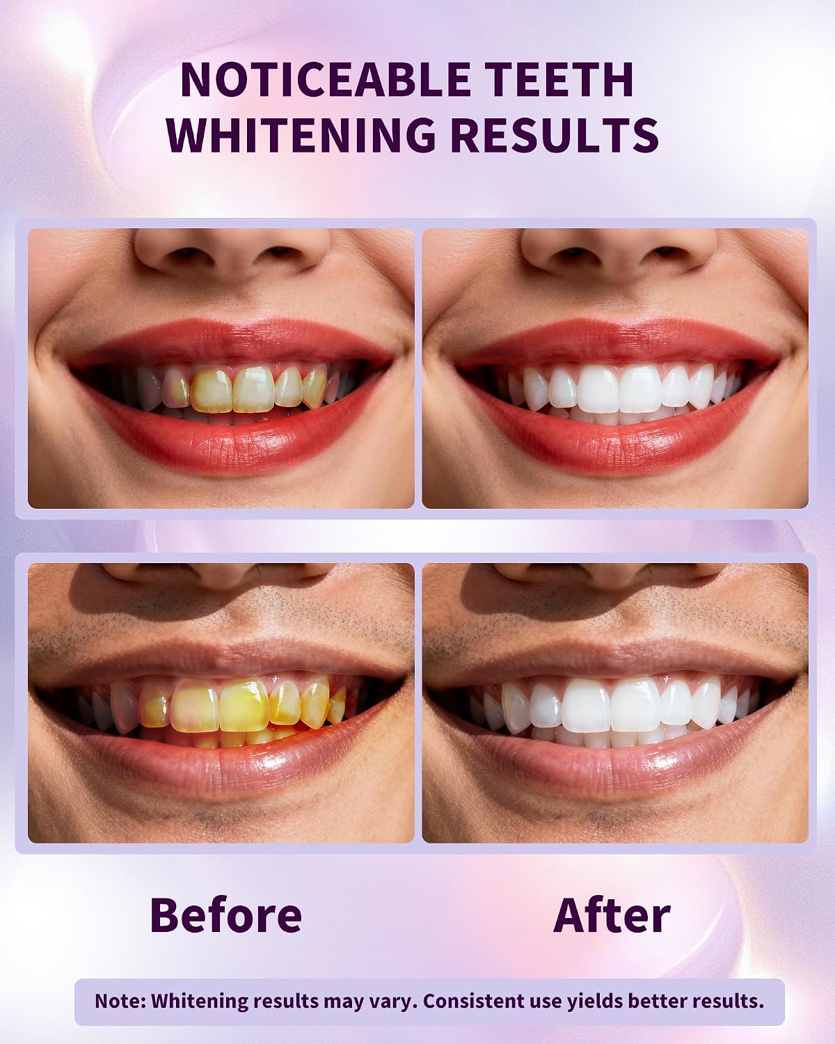 Thumbnail 2 de Ktintar 28 Strips Purple Teeth Whitening Strips for Sensitive Teeth