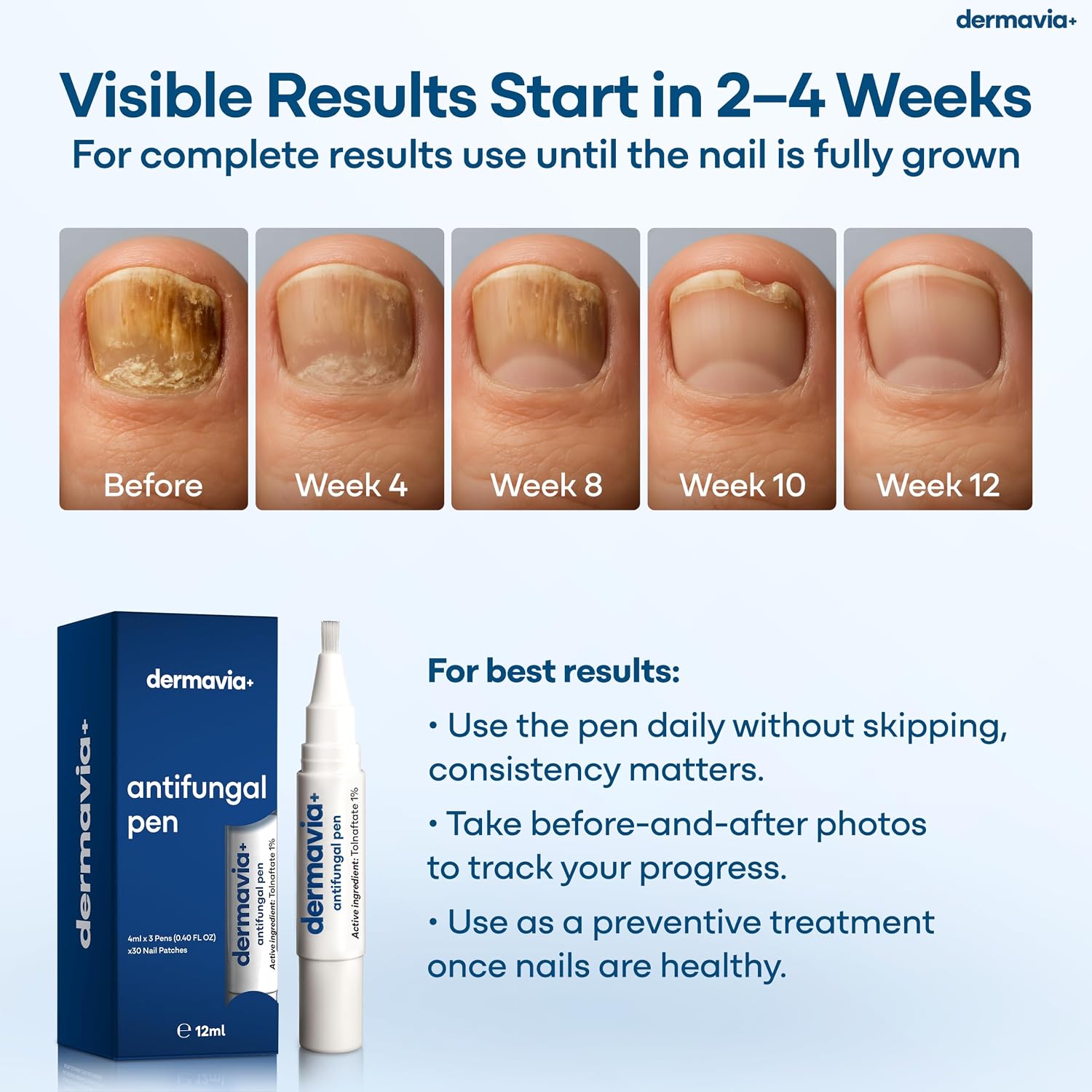Detalle de DERMAVIA+ Toenail Fungus Treatment Pen with Tolnaftate and Tea Tree, 12 mL