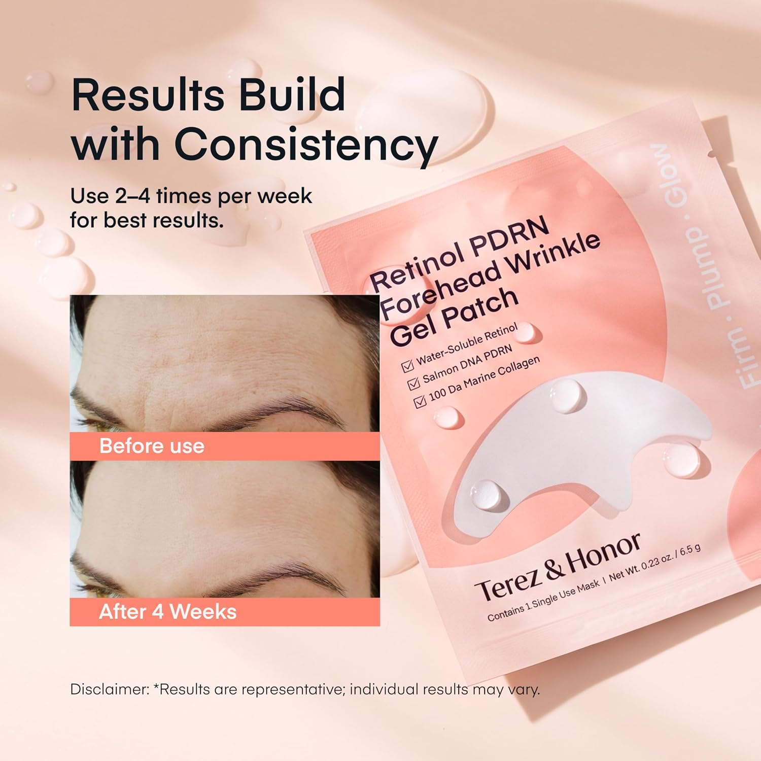 Detalle de TEREZ & HONOR Retinol PDRN Forehead Wrinkle Patches – Korean Hydrogel Mask for Forehead & Between Eyes