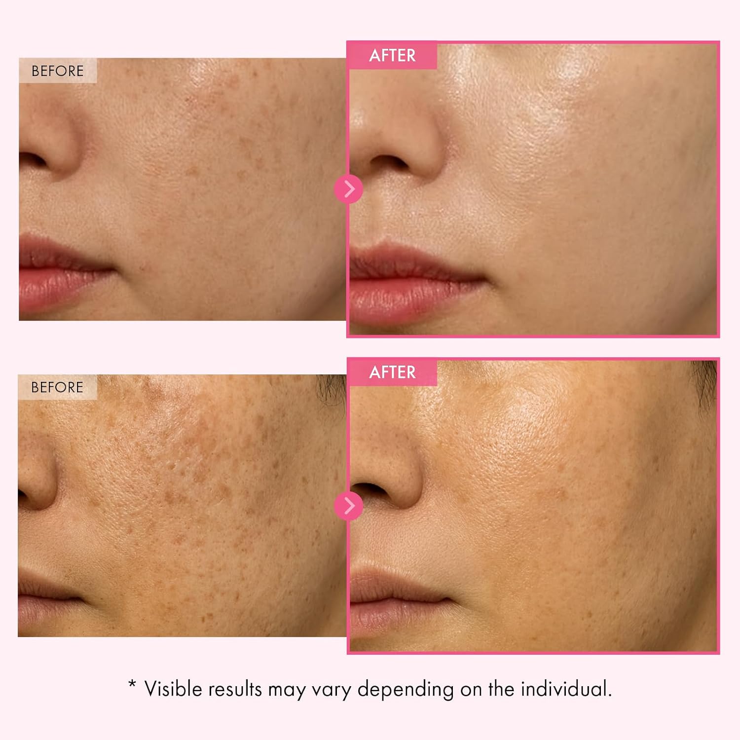 Detalle de TOSOWOONG Arbutin 7% Glutathione Cream: Brighten and even skin tone (50ml)