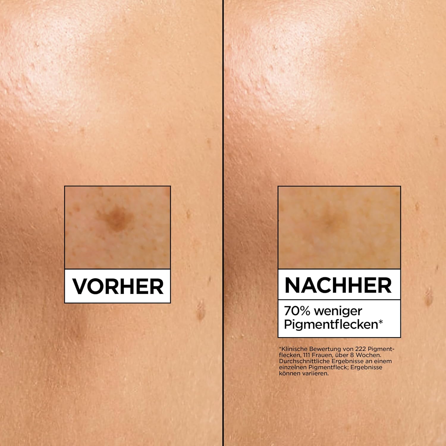 Detalle de Garnier Vitamin C Serum gegen Pigmentflecken – Glow Booster mit 4% Vitamin C (30 ml)