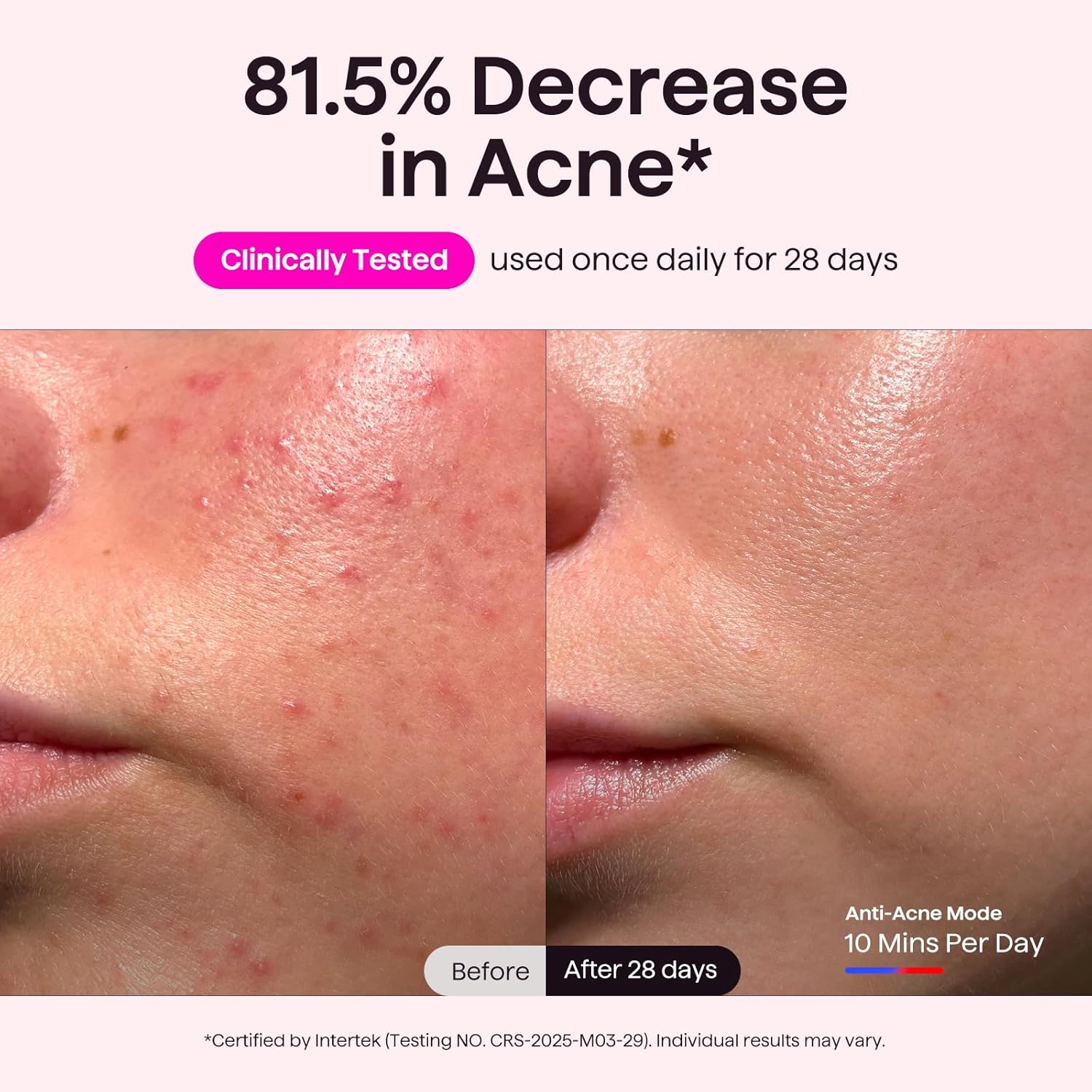 Thumbnail 3 de wavytalk Glow Time LED Red Light Therapy Mask for Face (Red, Near-Infrared, Blue & Amber)