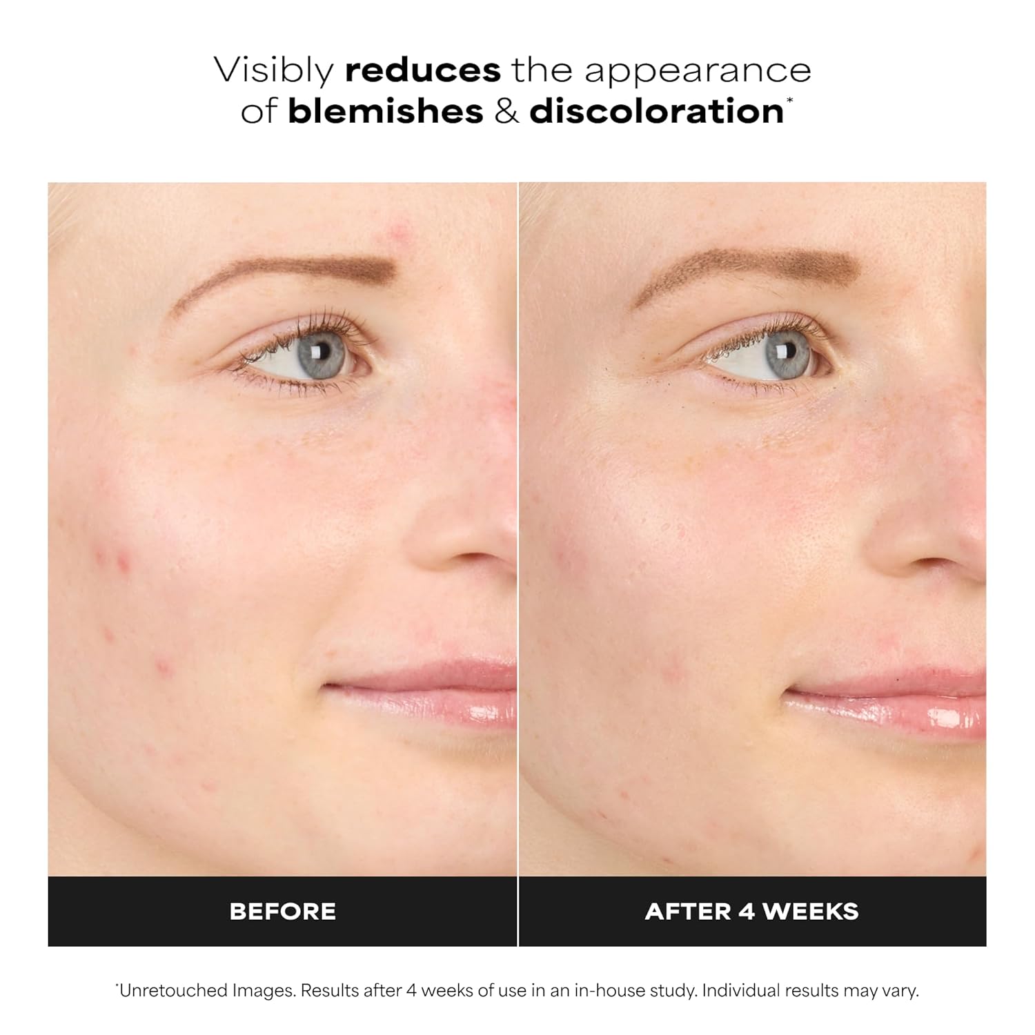 Thumbnail 2 de Paula's Choice BOOST 10% Azelaic Acid Booster Cream-Gel Serum with Salicylic Acid (Oil-Free, Fragrance-Free)