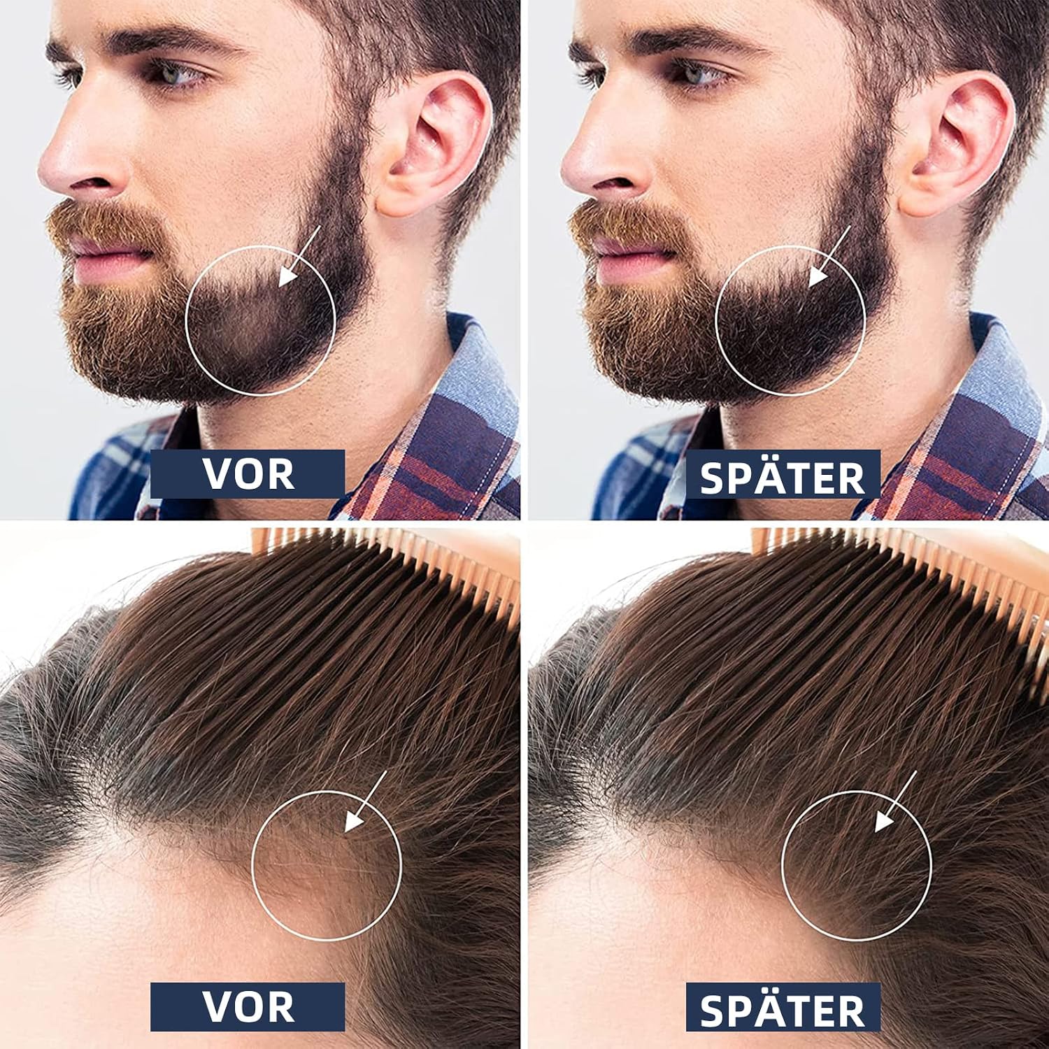 Detalle 2 de Beard Roller 0,5 mm Derma Roller 🧔