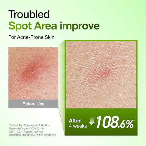 Detalle de ANUA Azelaic Acid 10 Hyaluron Redness Soothing Serum, 30ml