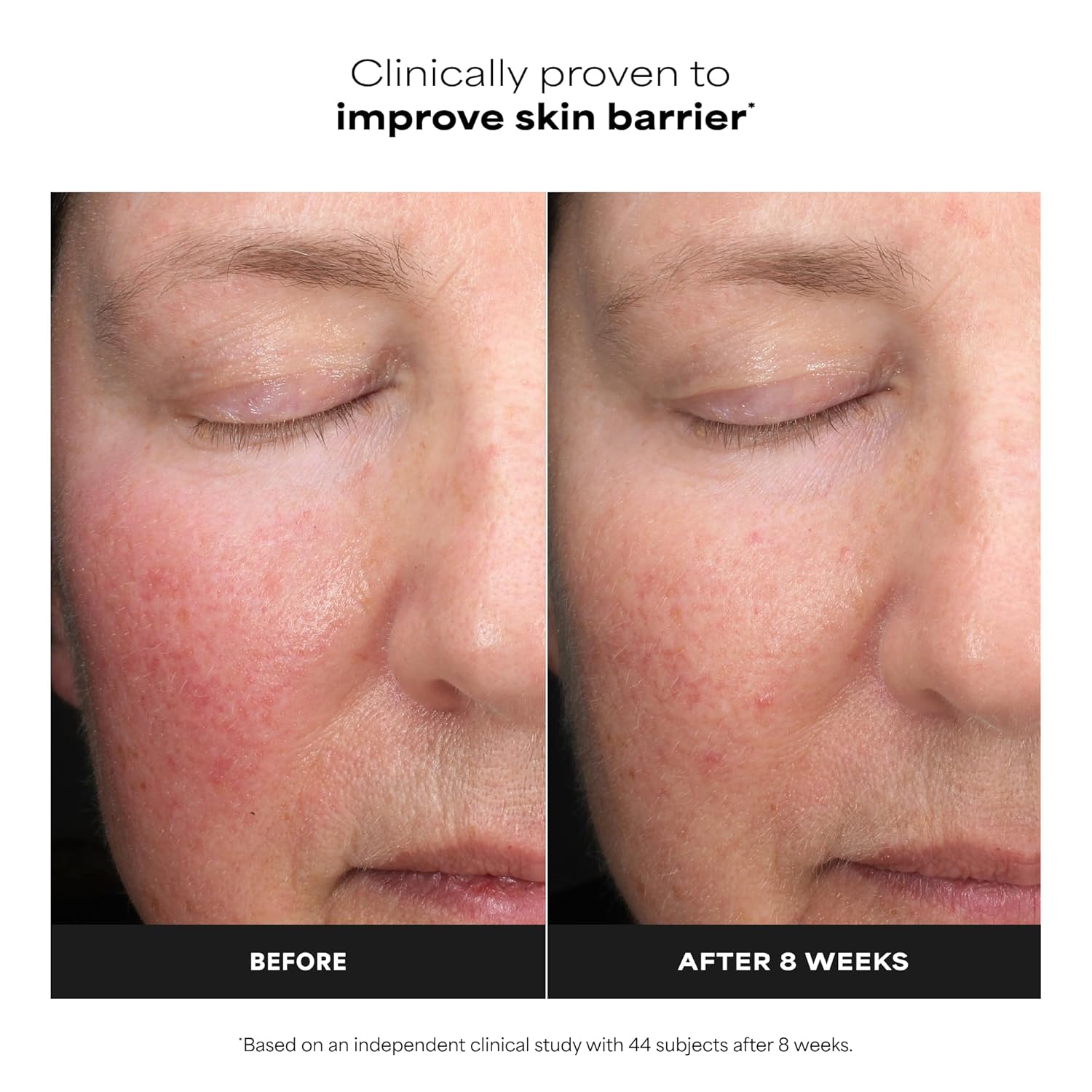 Detalle de Paula’s Choice 6% Mandelic Acid + 2% Lactic Acid Exfoliant