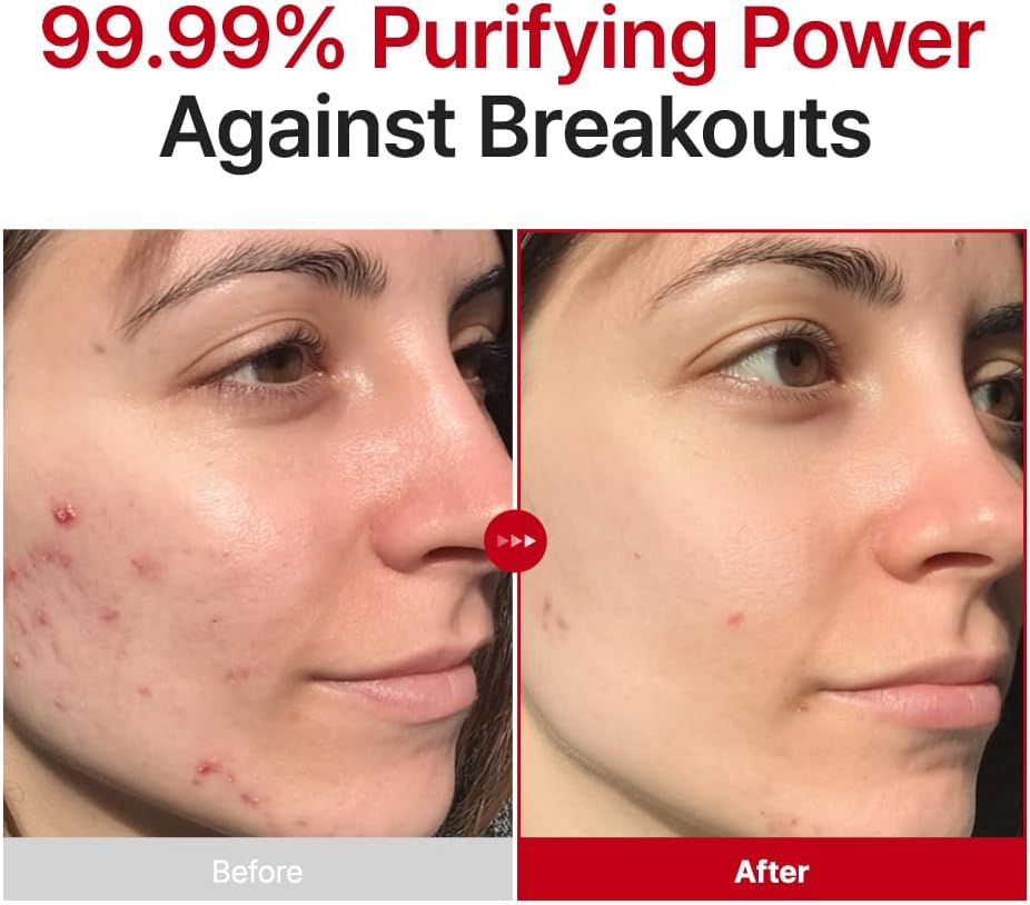 Detalle de PURITO Hypochlorous Acid Facial Spray | Witch Hazel 5% – Idrata e purifica la pelle sensibile