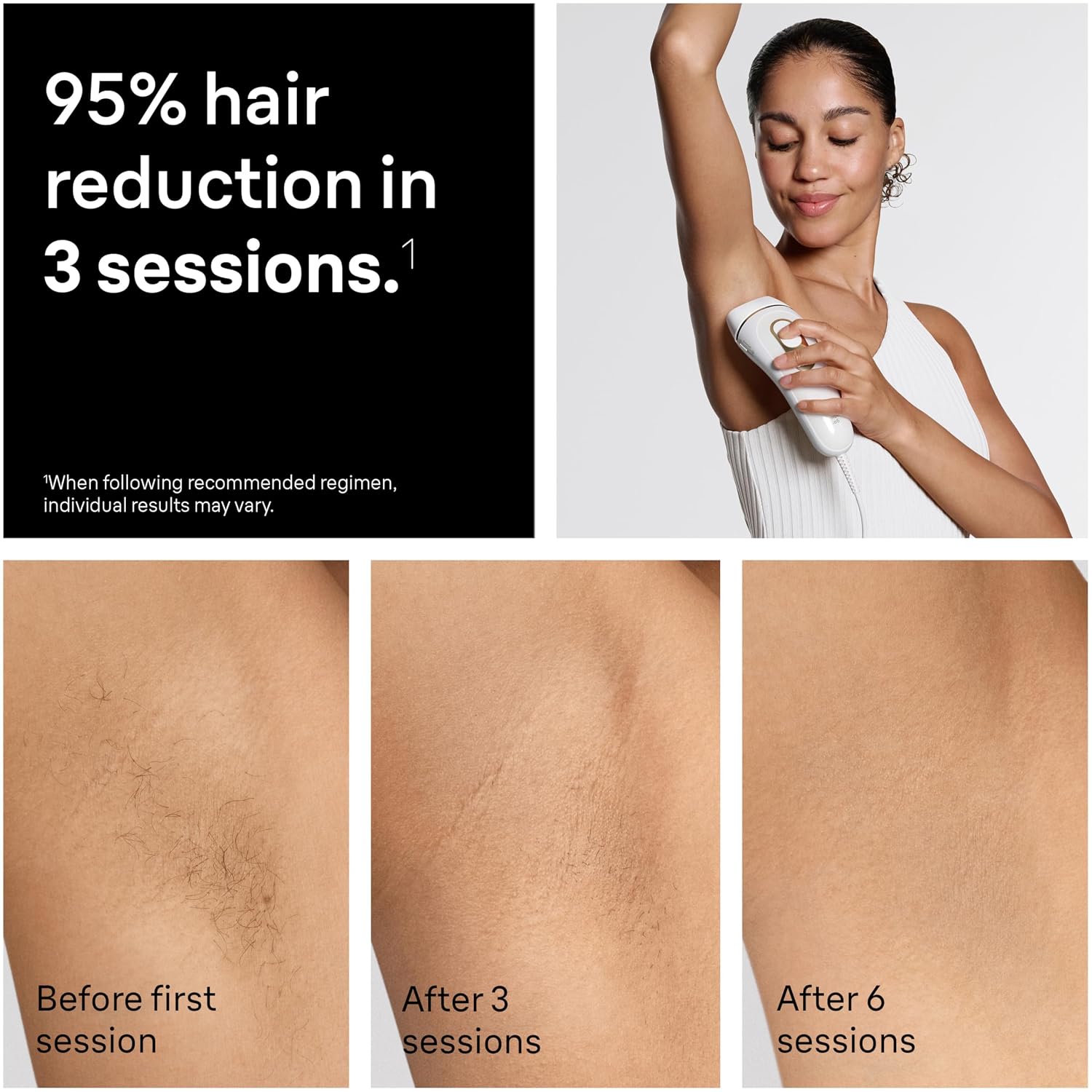 Detalle de Braun Silk Expert Pro 5 IPL5100 hair removal