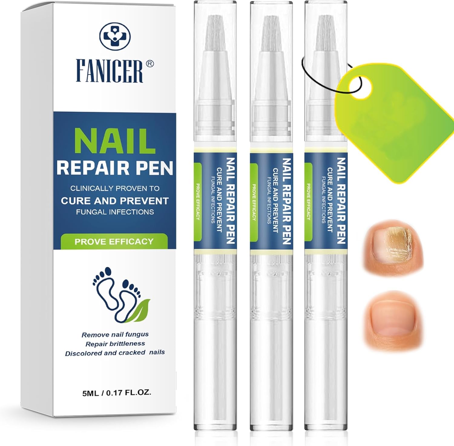 Stylos de soins 3 pièces pour ongles 🖊