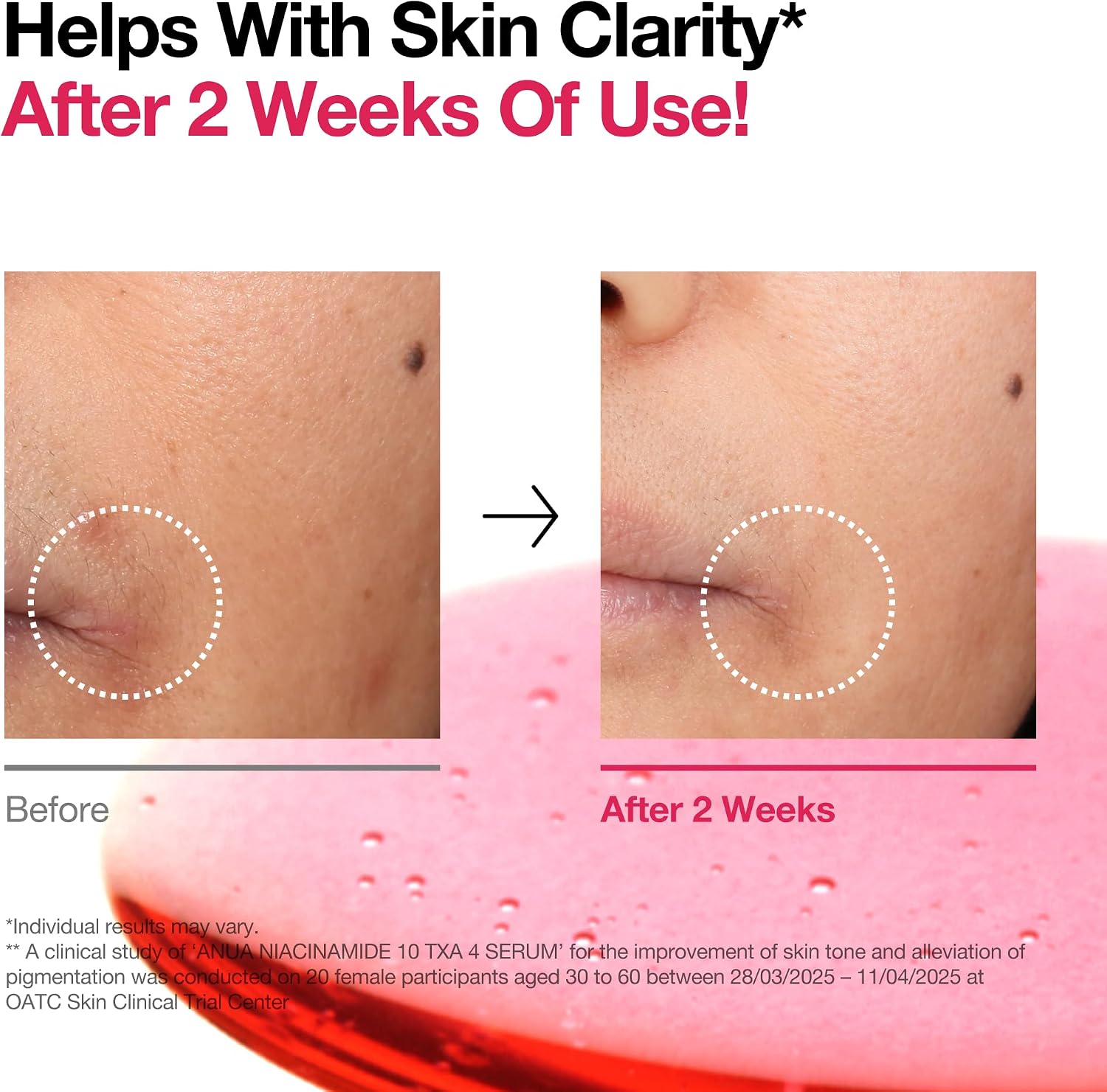 Thumbnail 5 de Anua Niacinamide 10 TXA 4 Serum