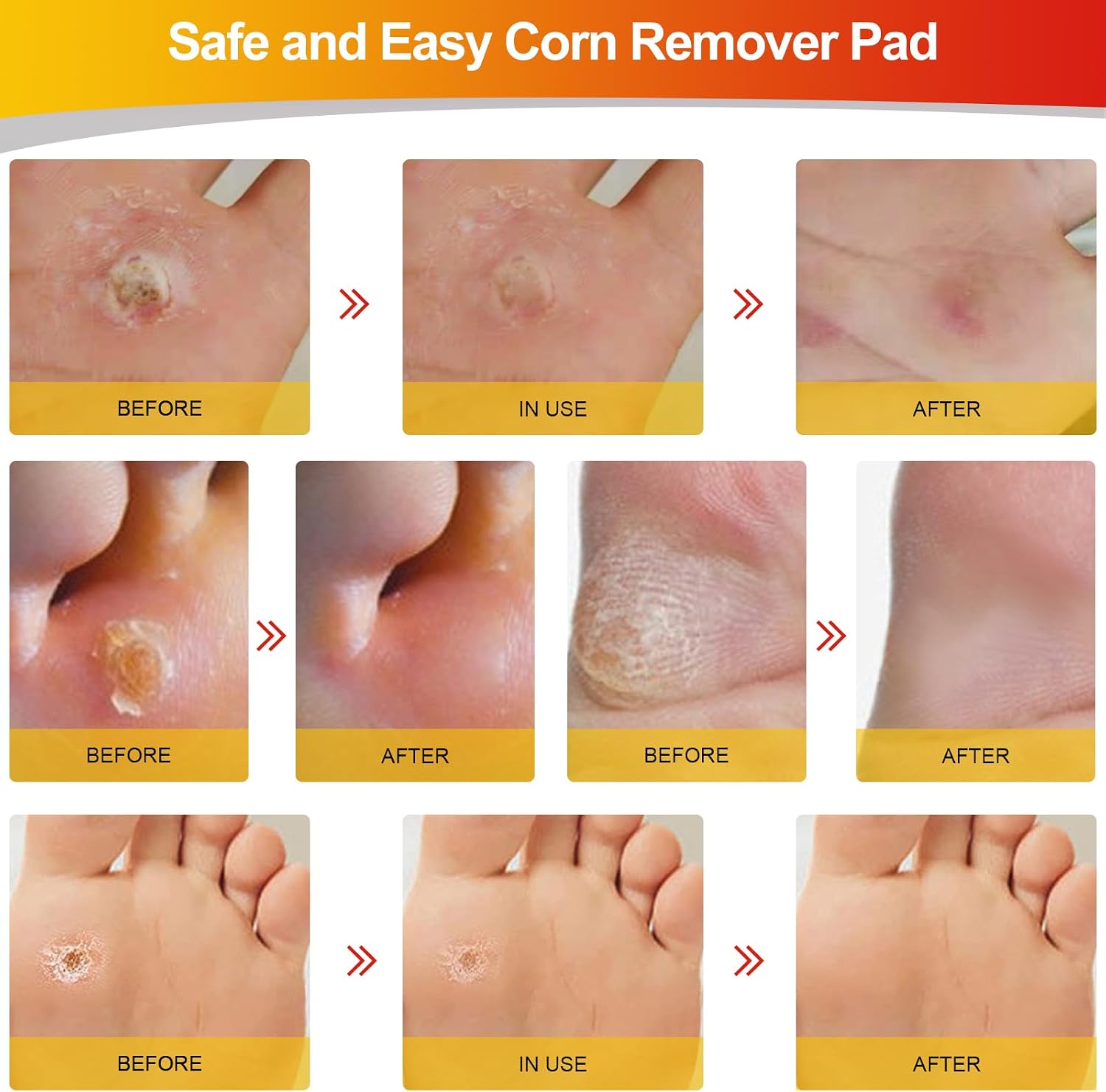 Thumbnail 6 de MYMULIKE Corn Removal Pads 24 Count