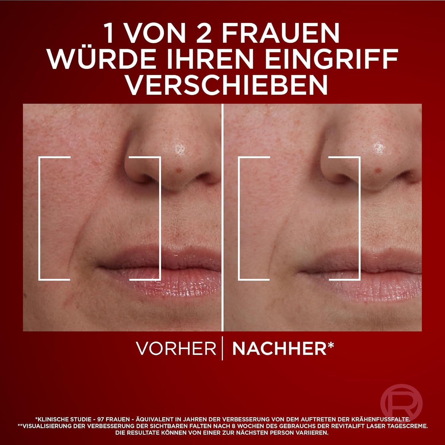 Detalle de L'Oréal Paris Revitalift Laser Dreifach-Wirkung Anti-Aging Tagescreme – 50 ml