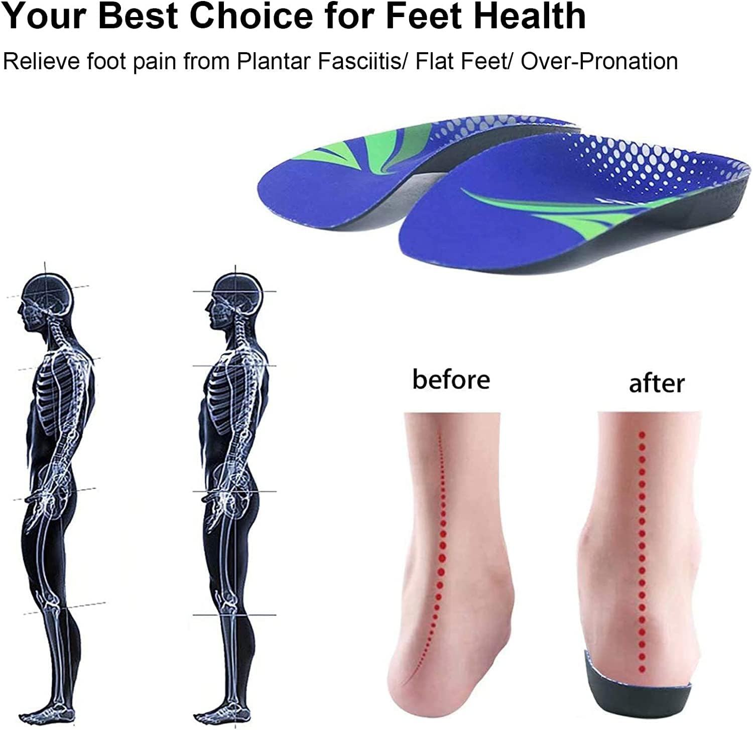 Detalle de RooRuns Orthotic Insoles 3/4 High Arch Support for Flat Feet & Plantar Fasciitis