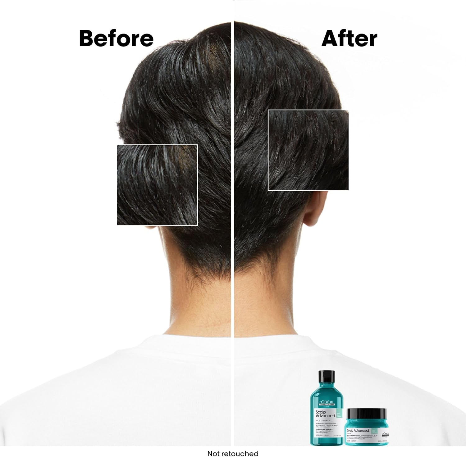 Thumbnail 2 de L'Oréal Professionnel Scalp Advanced Anti-Oiliness Dermo-Purifier Shampoo (300ml) – For Oily Hair, Serie Expert