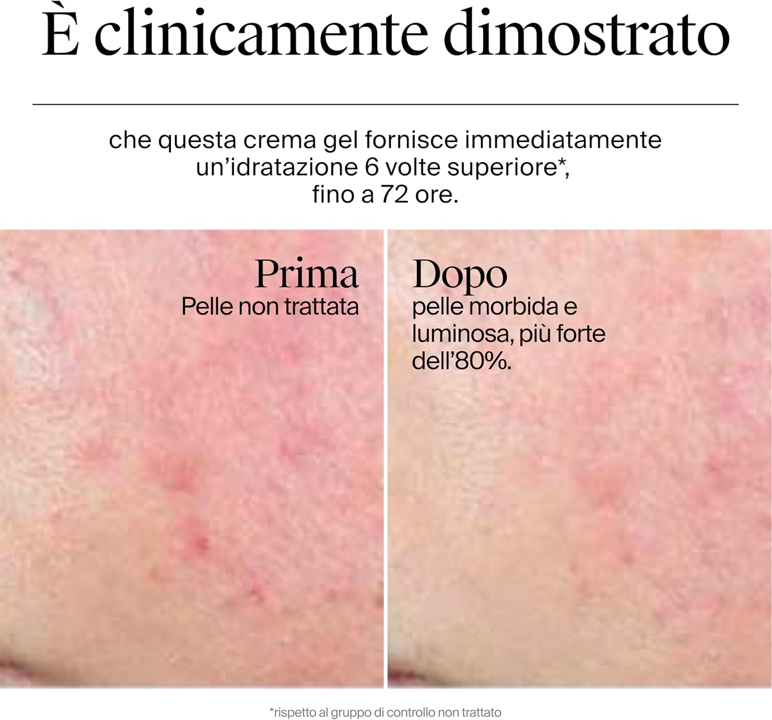 Detalle de Neutrogena Hydro Boost Crema Gel 50 ml