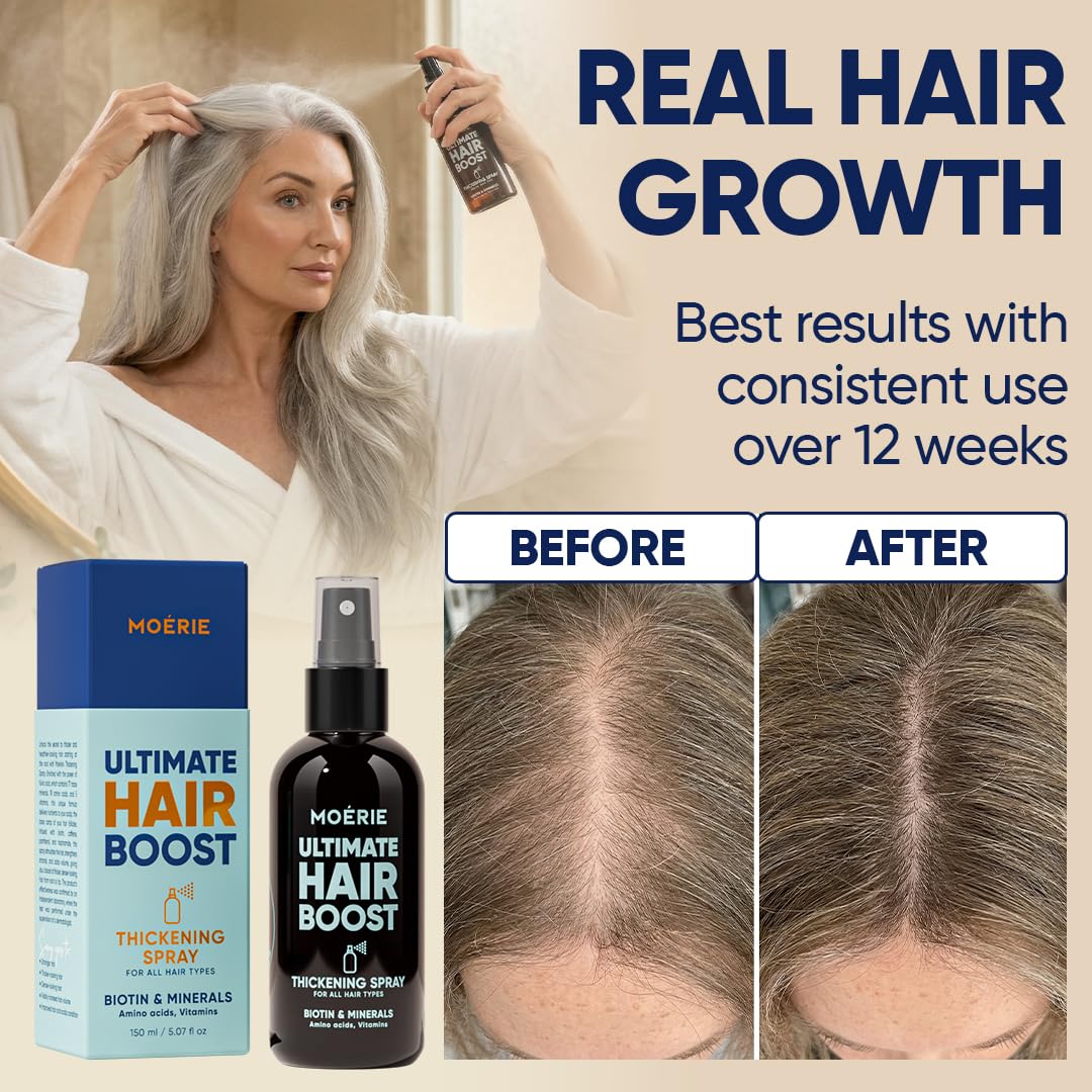 Detalle de Moerie Hair Growth Serum Spray for Men and Women: Biotin & Rosemary Formula for Thicker, Healthier Hair