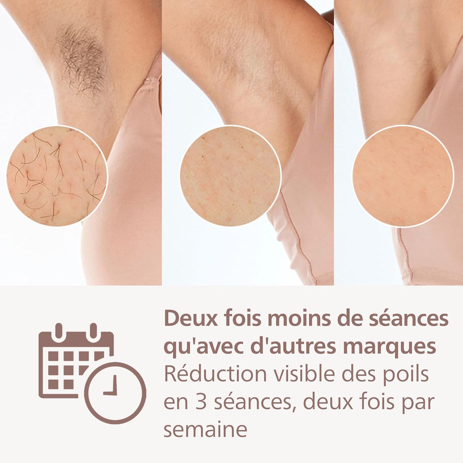Detalle de Philips Lumea série 9900 (BRI950/02) – Épilateur à lumière pulsée avec SkinAI et SenseIQ