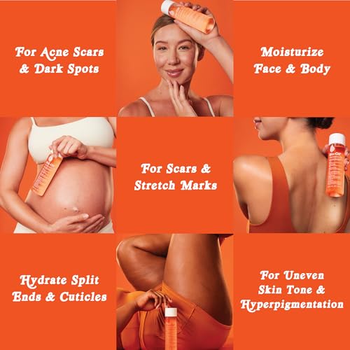 Detalle de Bio-Oil Skincare Body Oil Serum, Scars & Stretch Marks (2 fl oz)