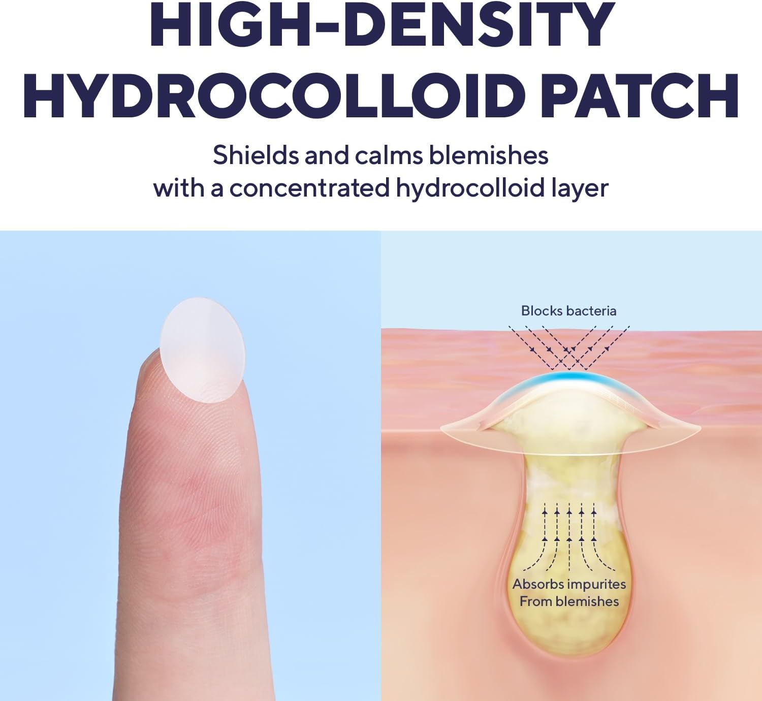 Detalle de caraseoul Patch Brufoli Notte – Pimple Patch Anti Acne, Hydrocolloid Denso con Bakuchiol e Aloe Vera (102 pezzi, 2 taglie 10/12 mm)