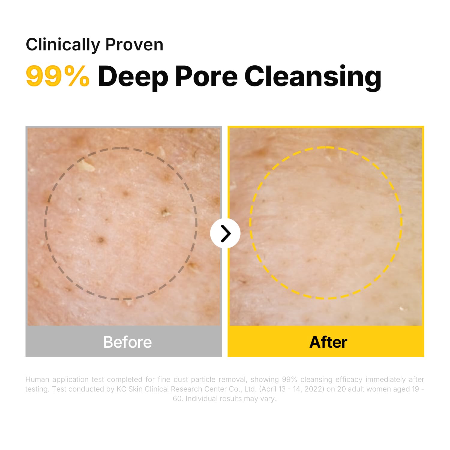 Thumbnail 4 de ma:nyo Pure Cleansing Oil (Natural Oil Cleanser) for Blackheads, Face Makeup & Sunscreen Cleanup — 6.76 fl oz