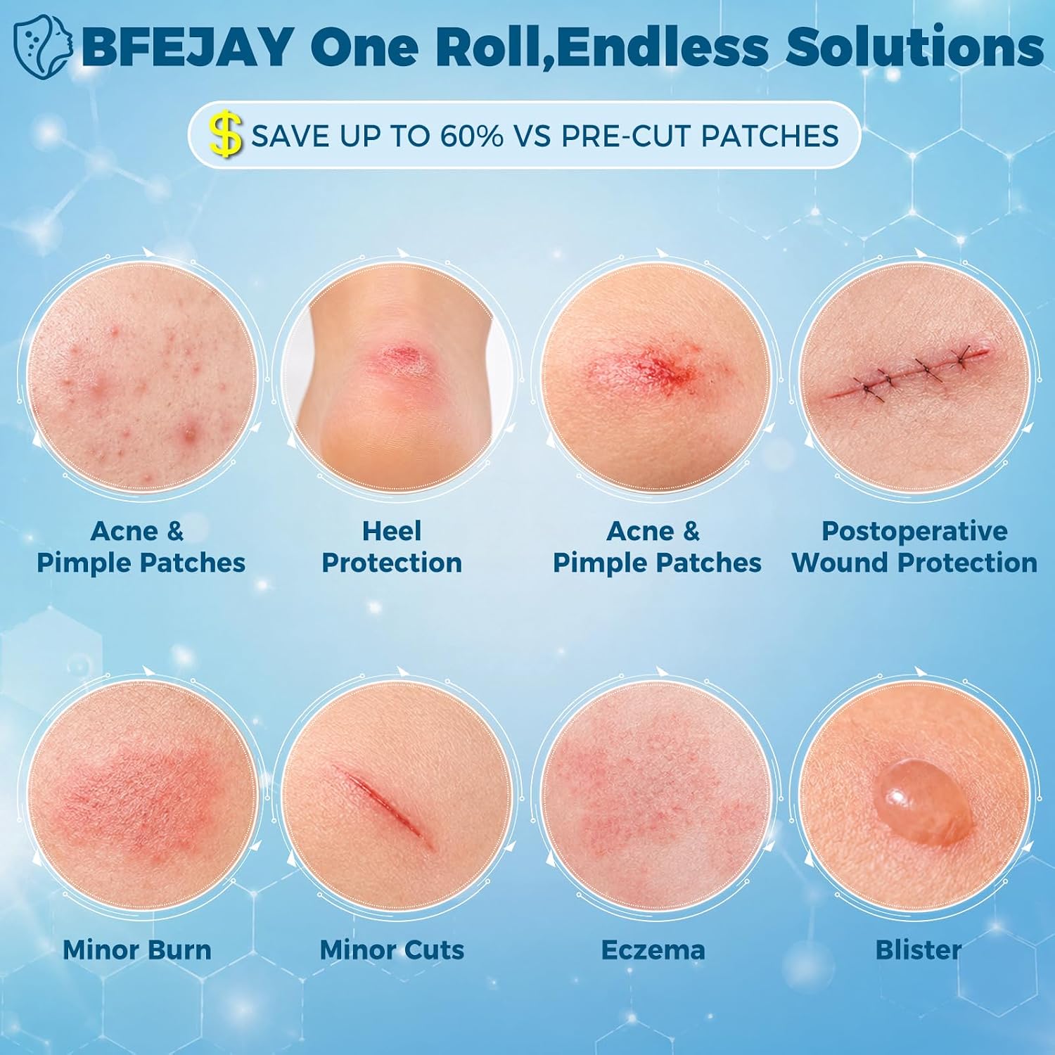 Detalle 2 de BFEJAY Hydrocolloid Bandage Roll, 2 in x 4.8 ft, Cut-to-Size and Waterproof