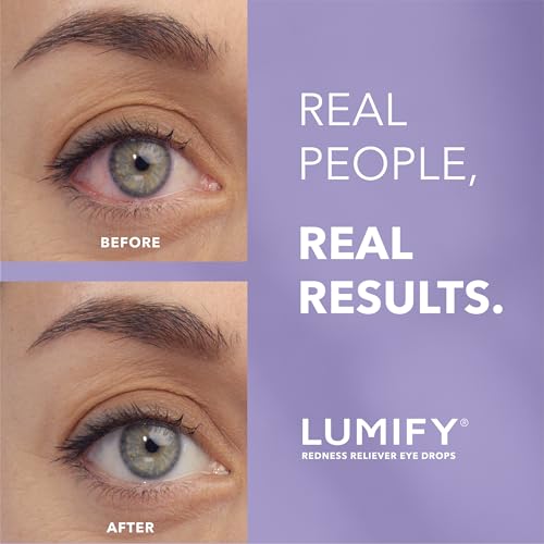 Detalle de LUMIFY Eye Drops for Red Eyes – Brimonidine Redness Reliever (0.25 Fl Oz / 7.5 mL)