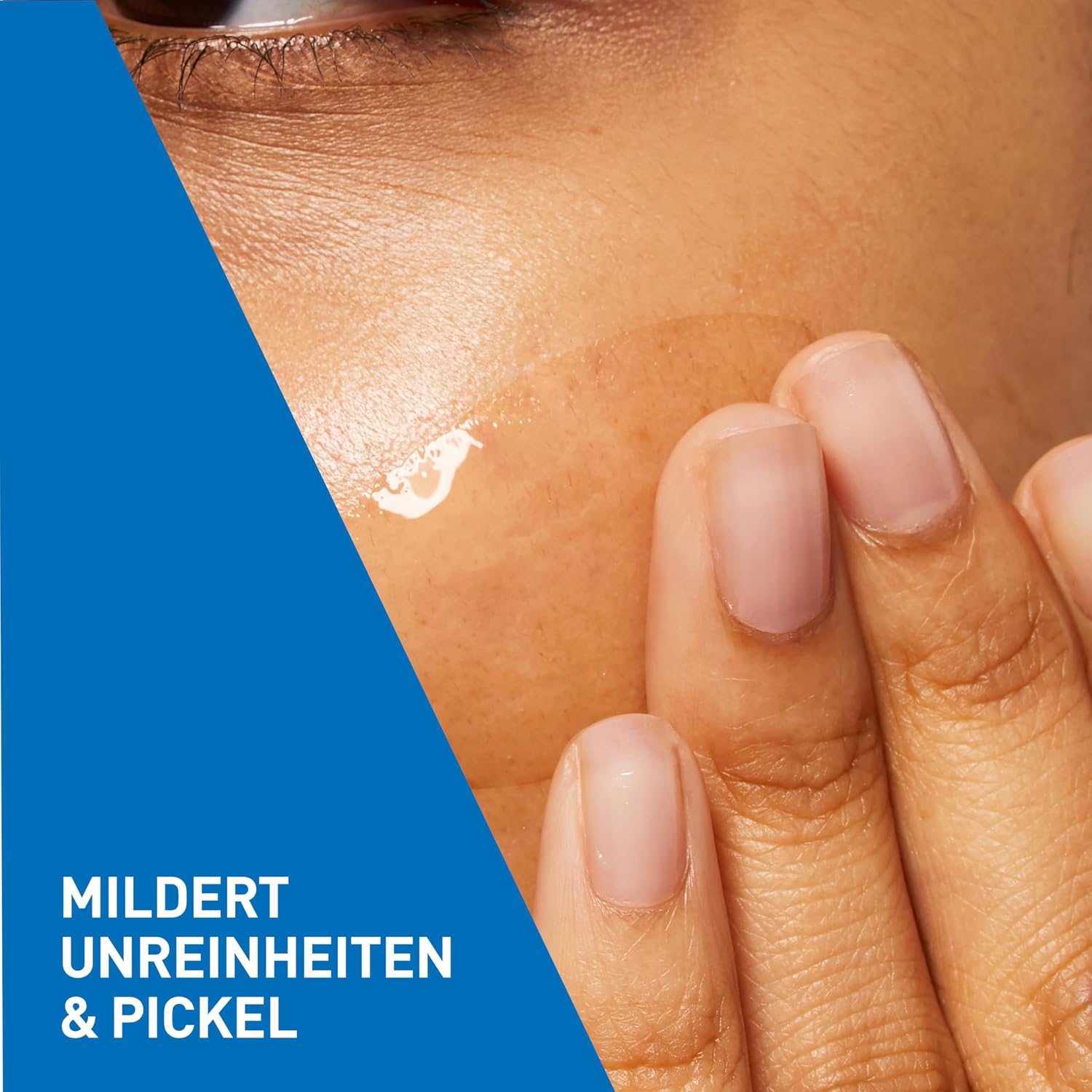 Detalle de CeraVe Anti-Unreinheiten Gel – Peelingeffekt gegen unreine Haut (40 ml)