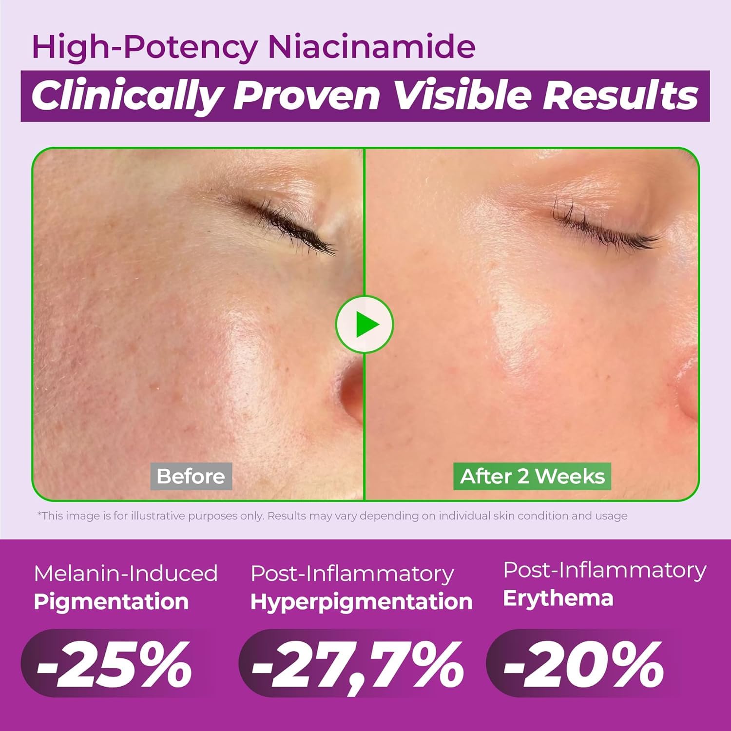 Thumbnail 5 de JUMISO Niacinamide 20% Serum 40ml