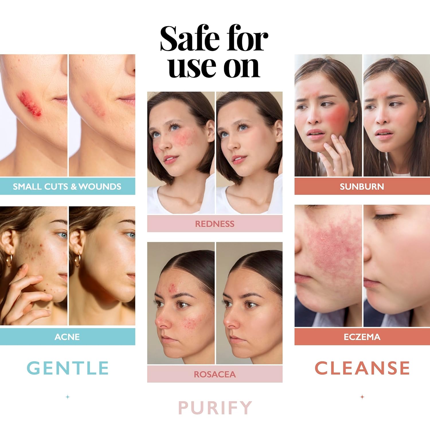 Detalle de Aquia Hypochlorous Acid Spray for Face and Skin (8oz) — Antimicrobial Facial Cleanser & Face Mist