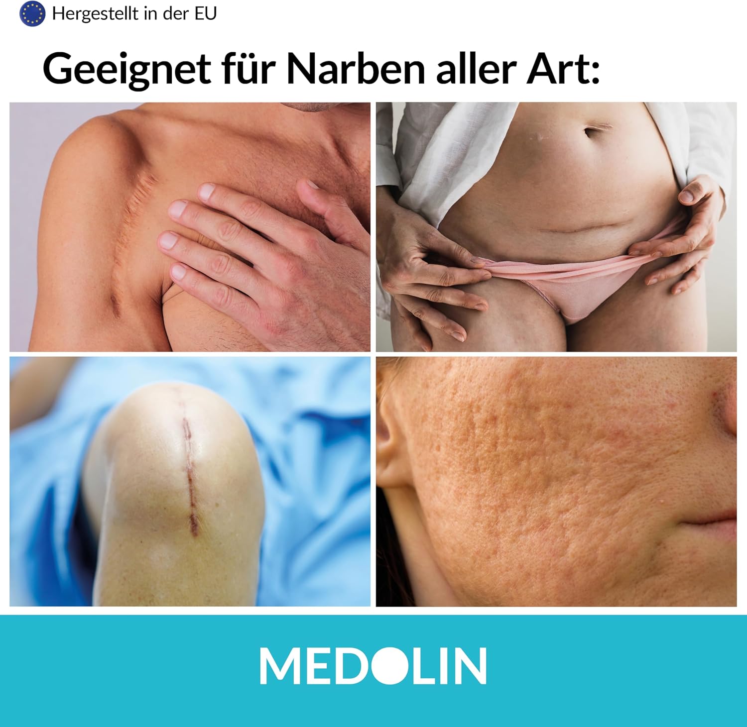 Detalle de Medolin® Narbengel 20 ml Narbensalbe