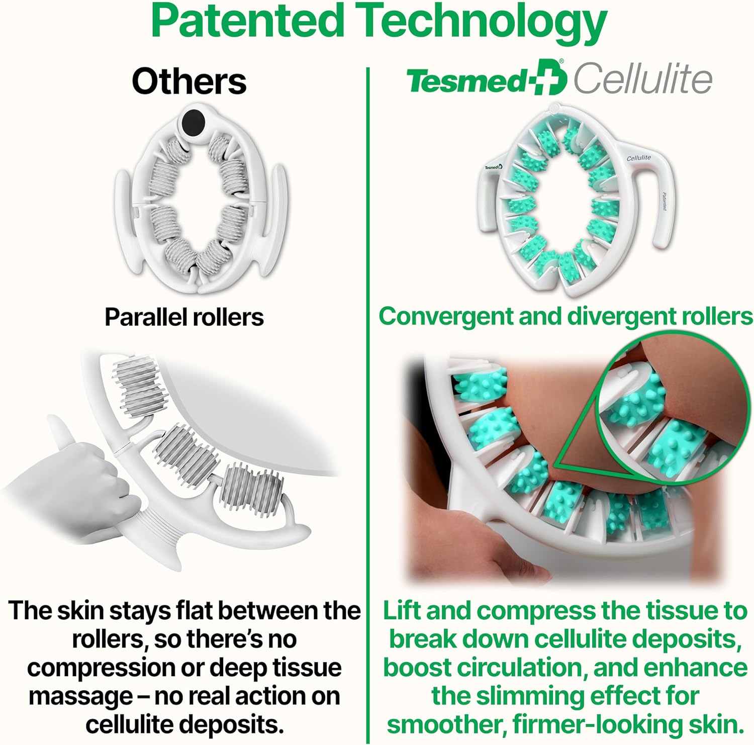 Detalle de TESMED Cellulite Manual Patented Massager 9–38 cm