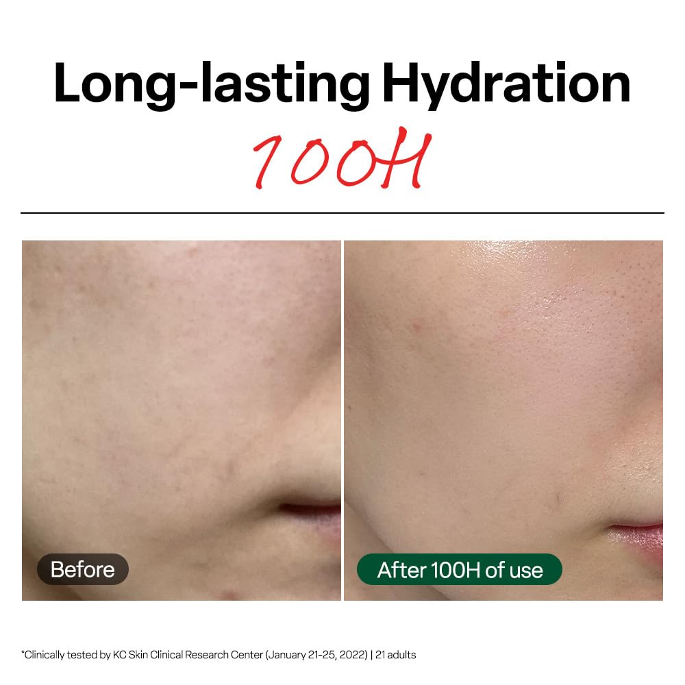 Thumbnail 2 de Dr. G R.E.D. Blemish Clear Soothing Cream – Calming Korean Moisturizer for Redness