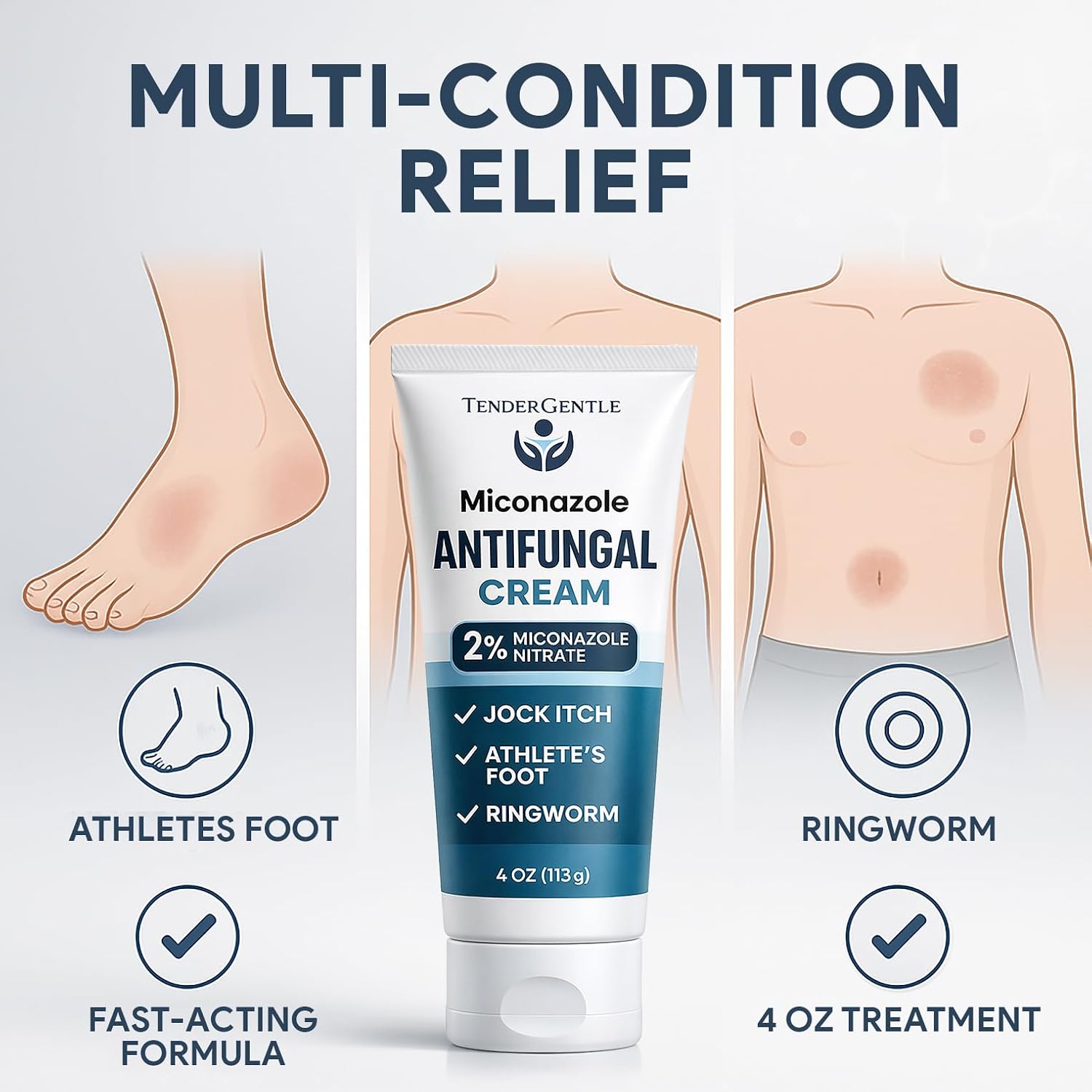Detalle de TenderGentle Miconazole Antifungal Cream, 2% Miconazole Nitrate, 4 oz