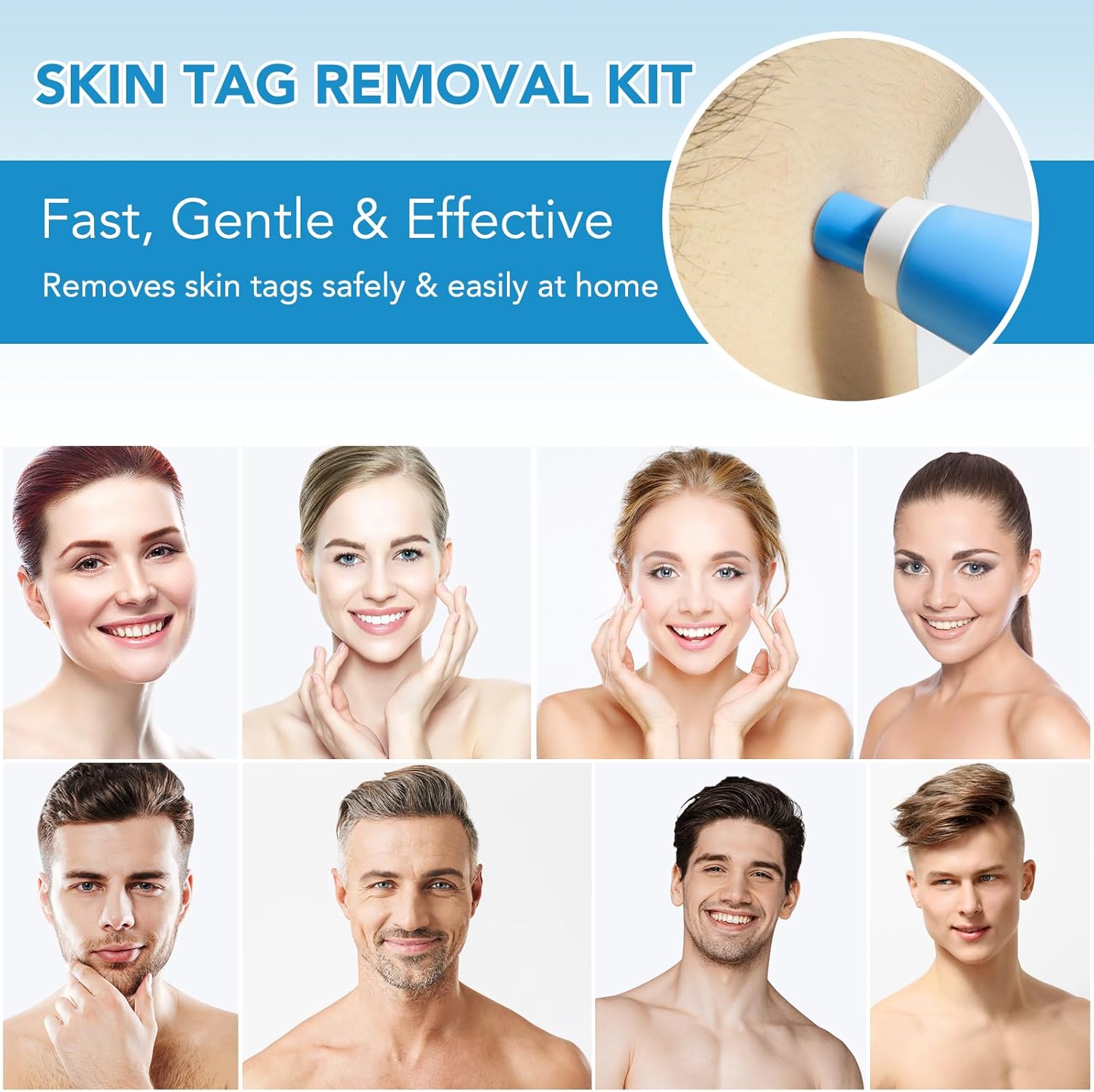 Thumbnail 6 de Auto Skin Tag Removal Kit – Wart Remover Pen with 40 Removal Bands & 10 Cleansing Wipes (2mm–8mm)