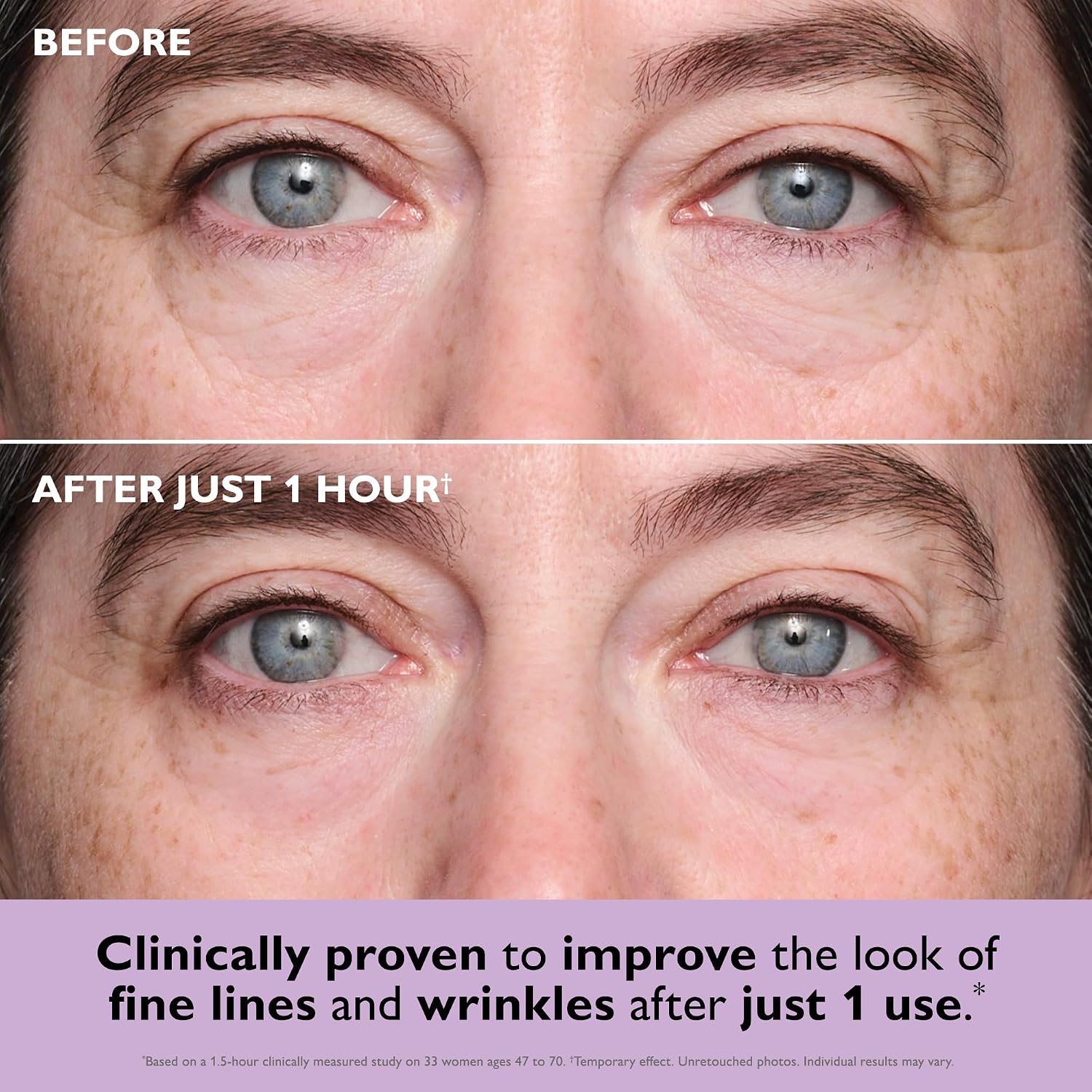Thumbnail 4 de Peter Thomas Roth Instant FIRMx Eye Patches