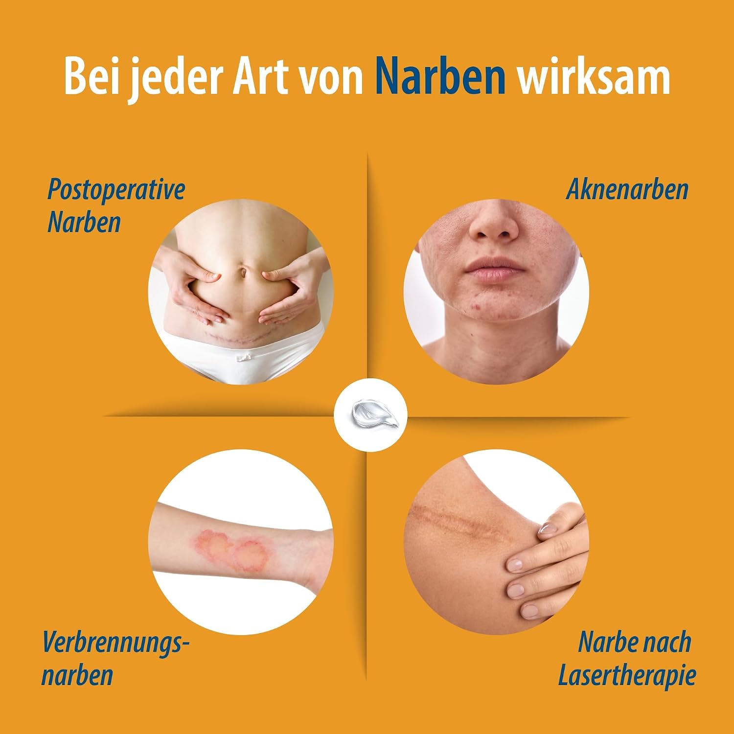 Detalle de Evolsin® Narbengel für Kinder & Erwachsene – Narbensalbe gegen Juckreiz & Gewebespannung (20 g)