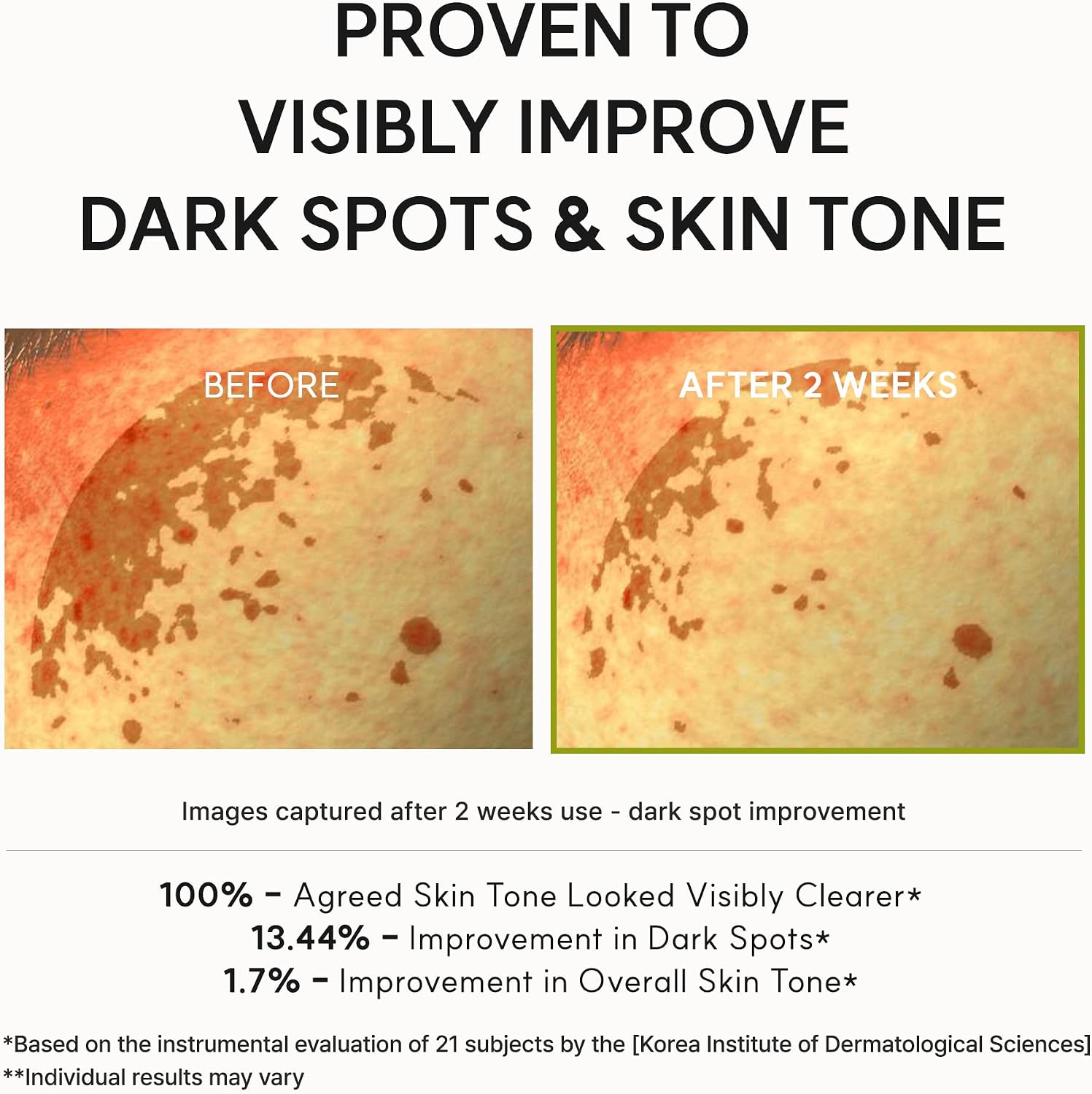 Thumbnail 5 de ARENCI A Vitamin C Booster Shot Serum with Glutathione, Niacinamide and Vitamin E (30ml)